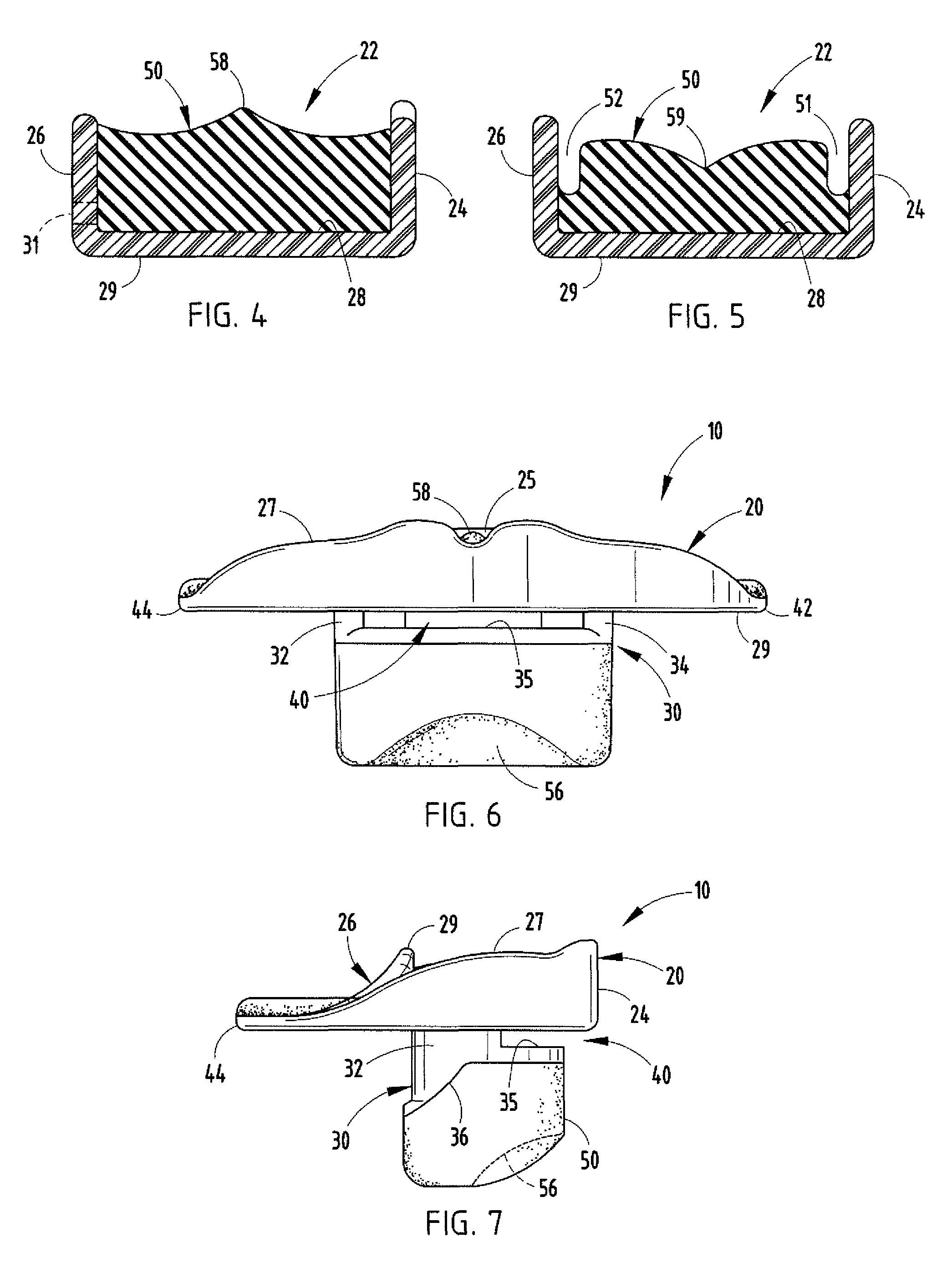 Oral orthosis handle