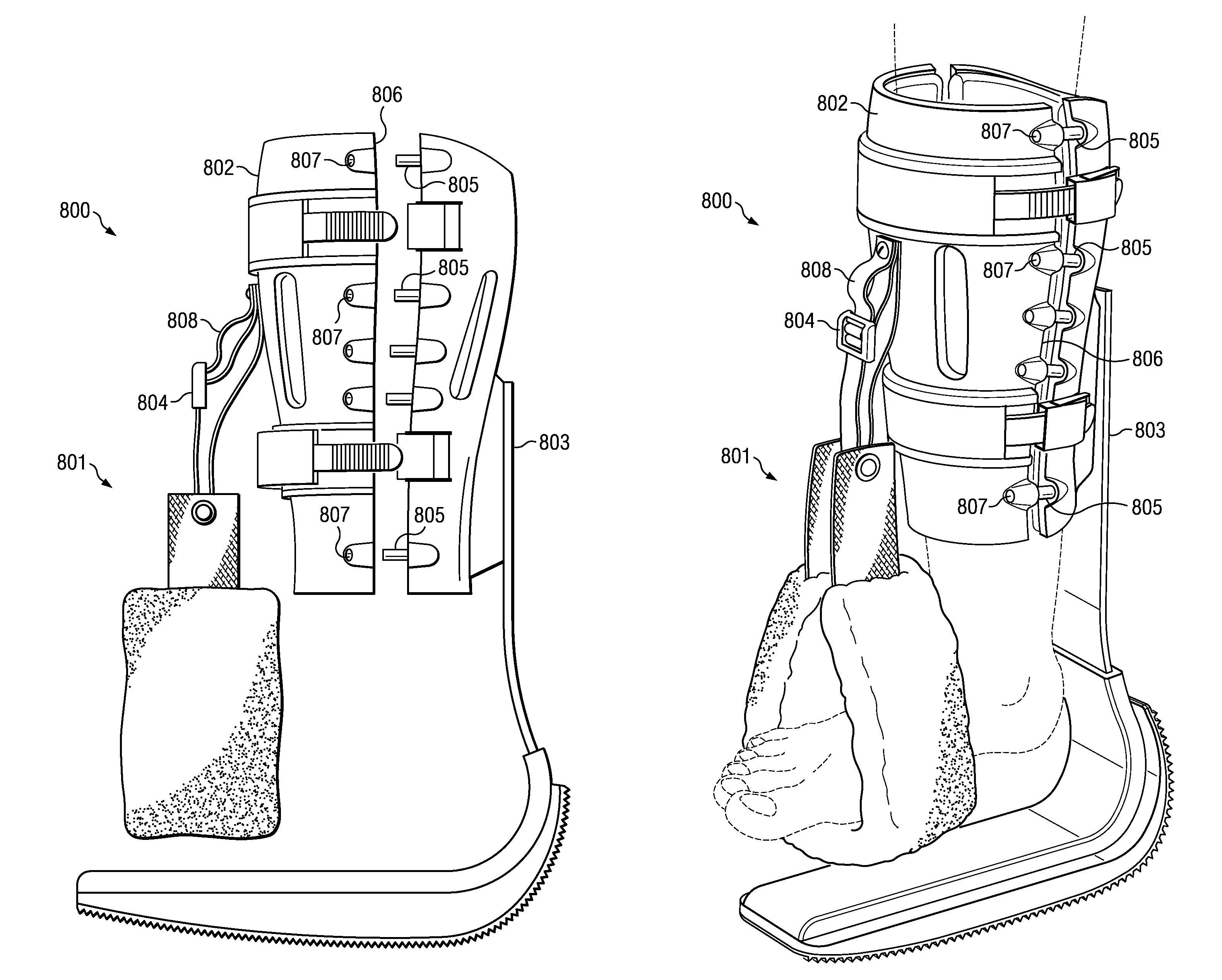 Weight-bearing lower extremity brace