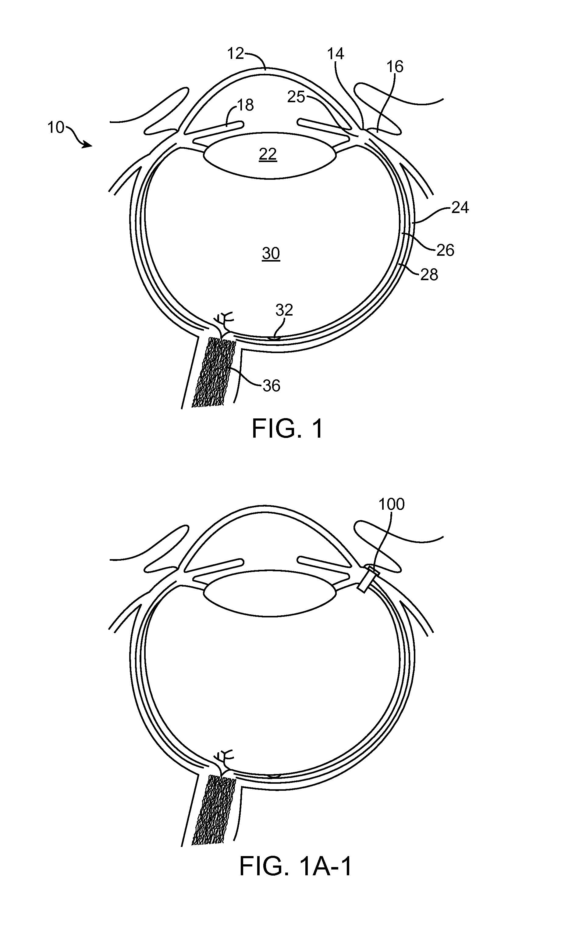 Combined drug delivery methods and apparatus