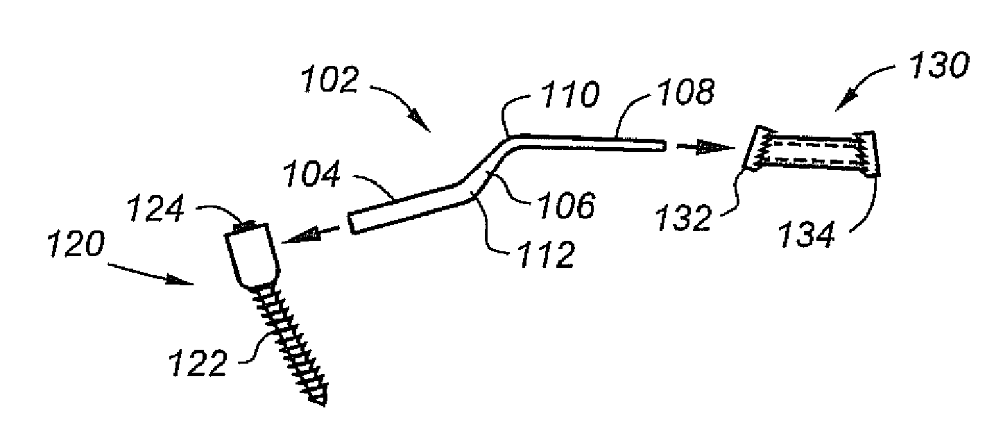 Laminoplasty apparatus and methods