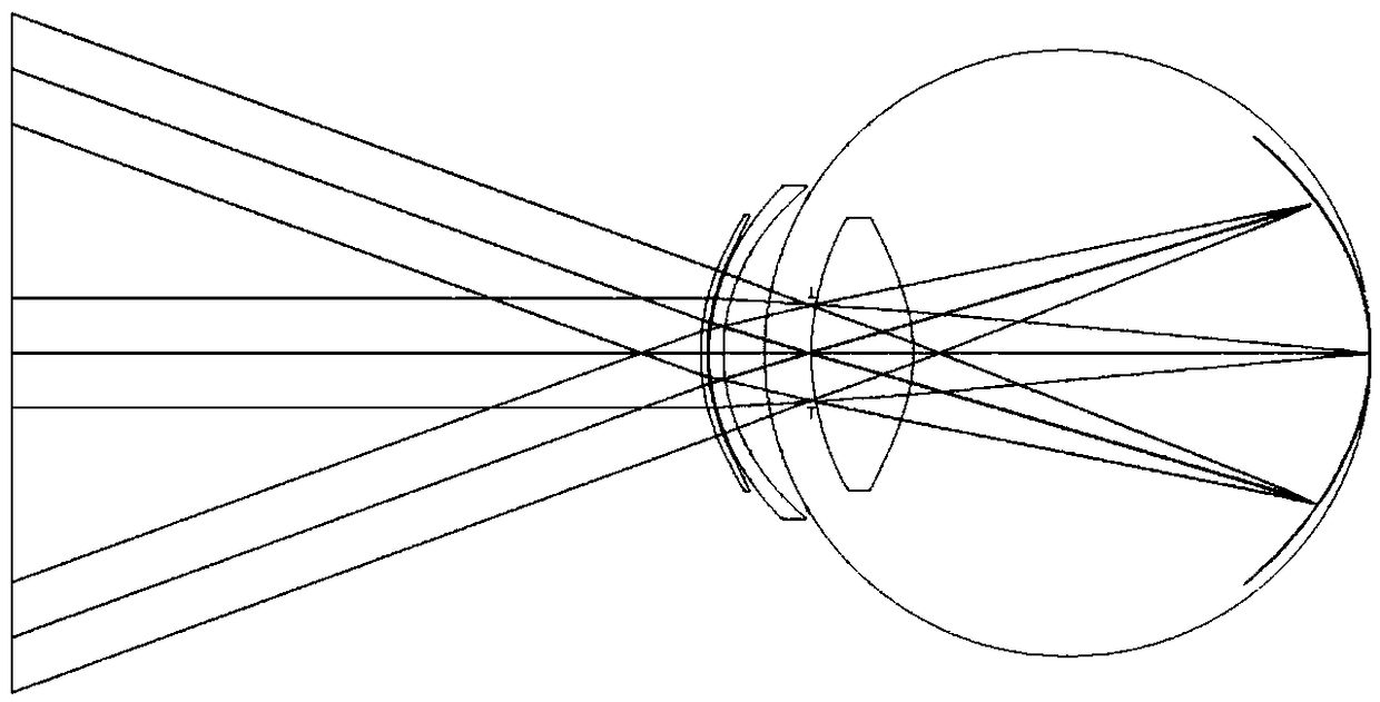 Hard contact lens capable of relieving paracentral hyperopic defocus and manufacturing method of hard contact lens