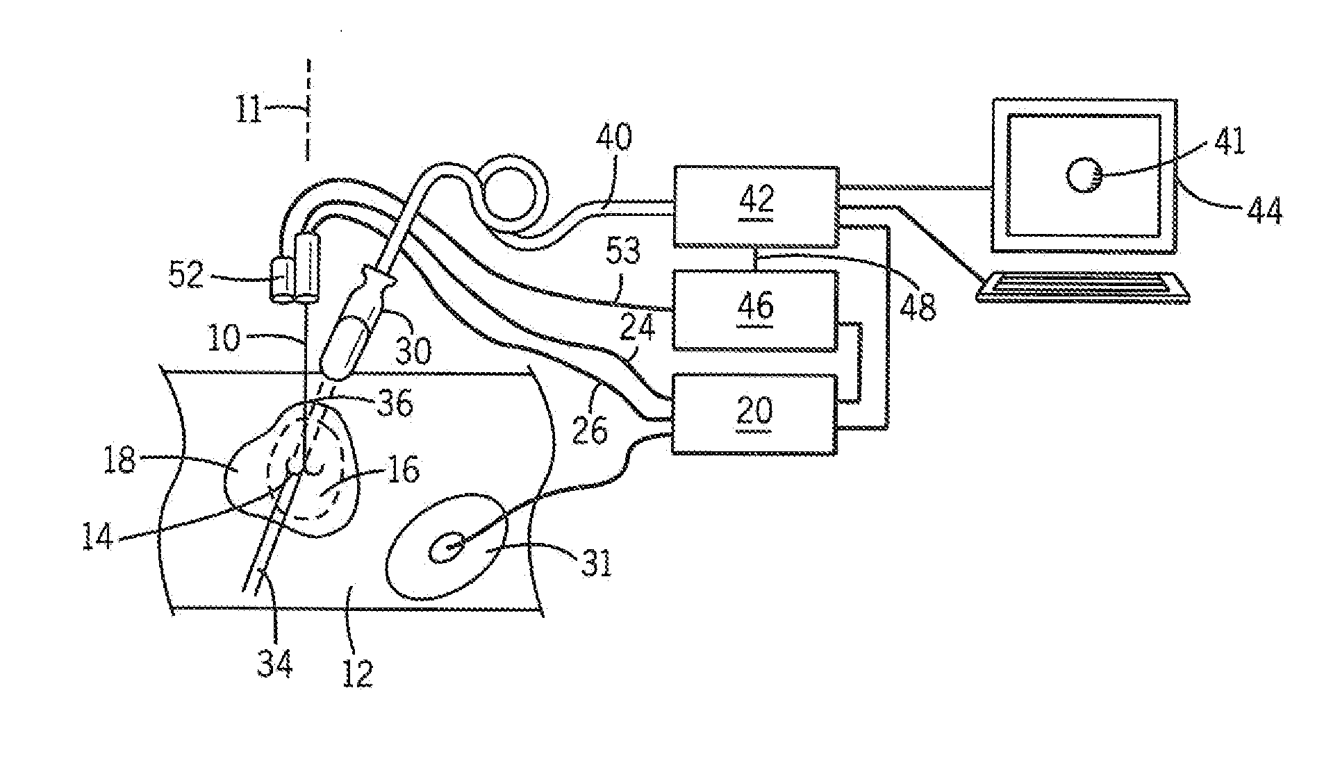 Method and Apparatus for Rapid Acquisition of Elasticity Data in Three Dimensions