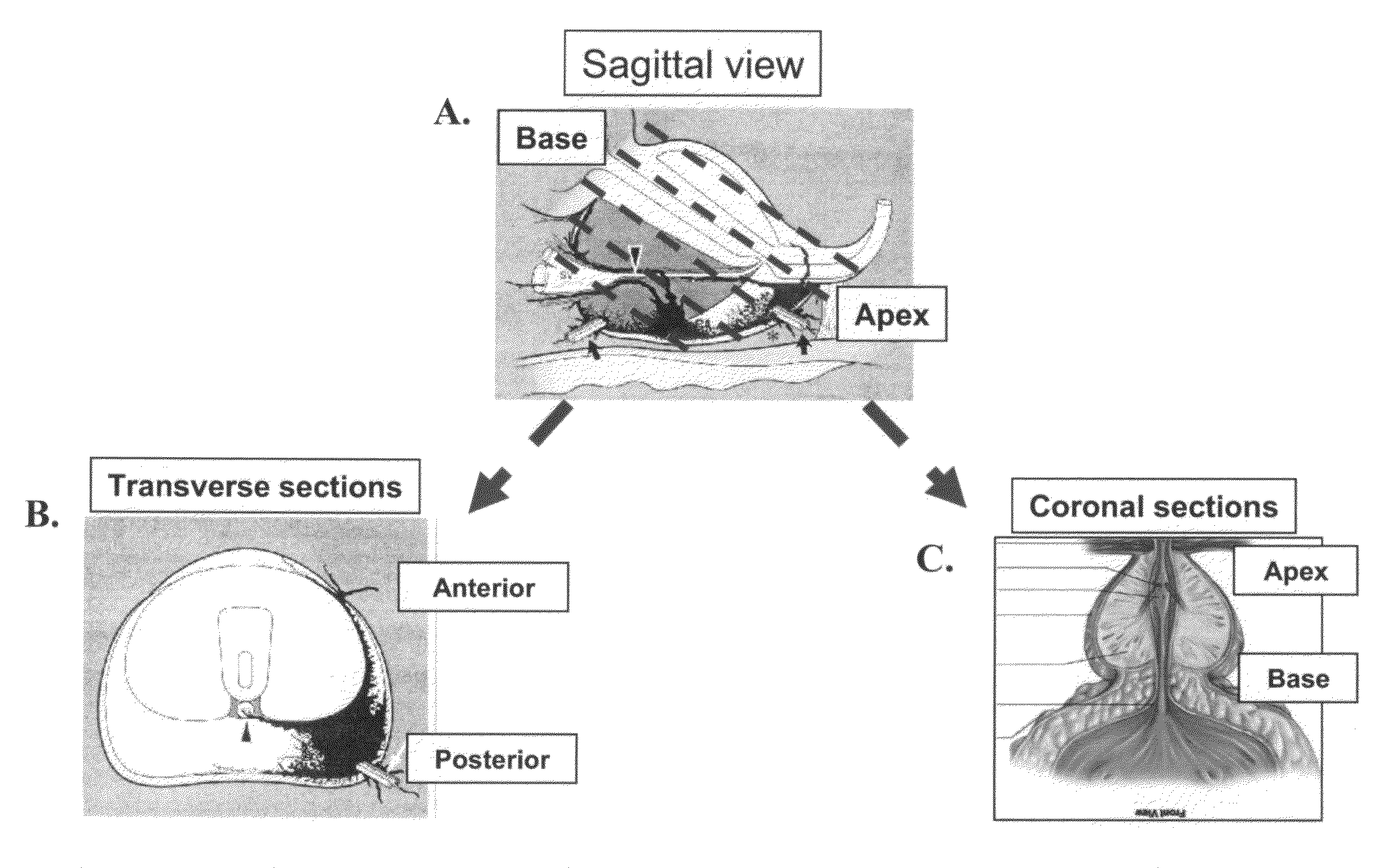 Methods of Detecting Prostate Cancer