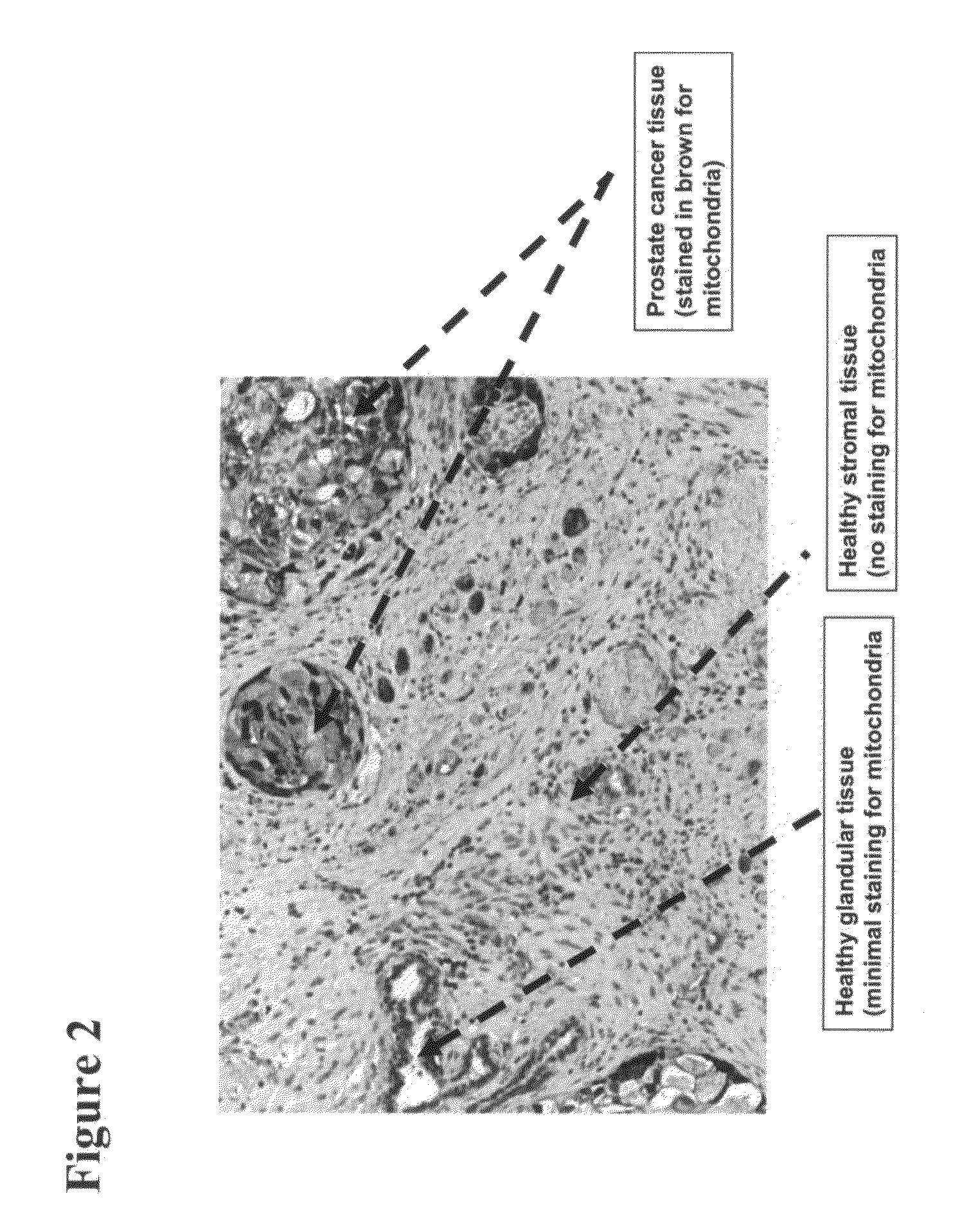 Methods of Detecting Prostate Cancer