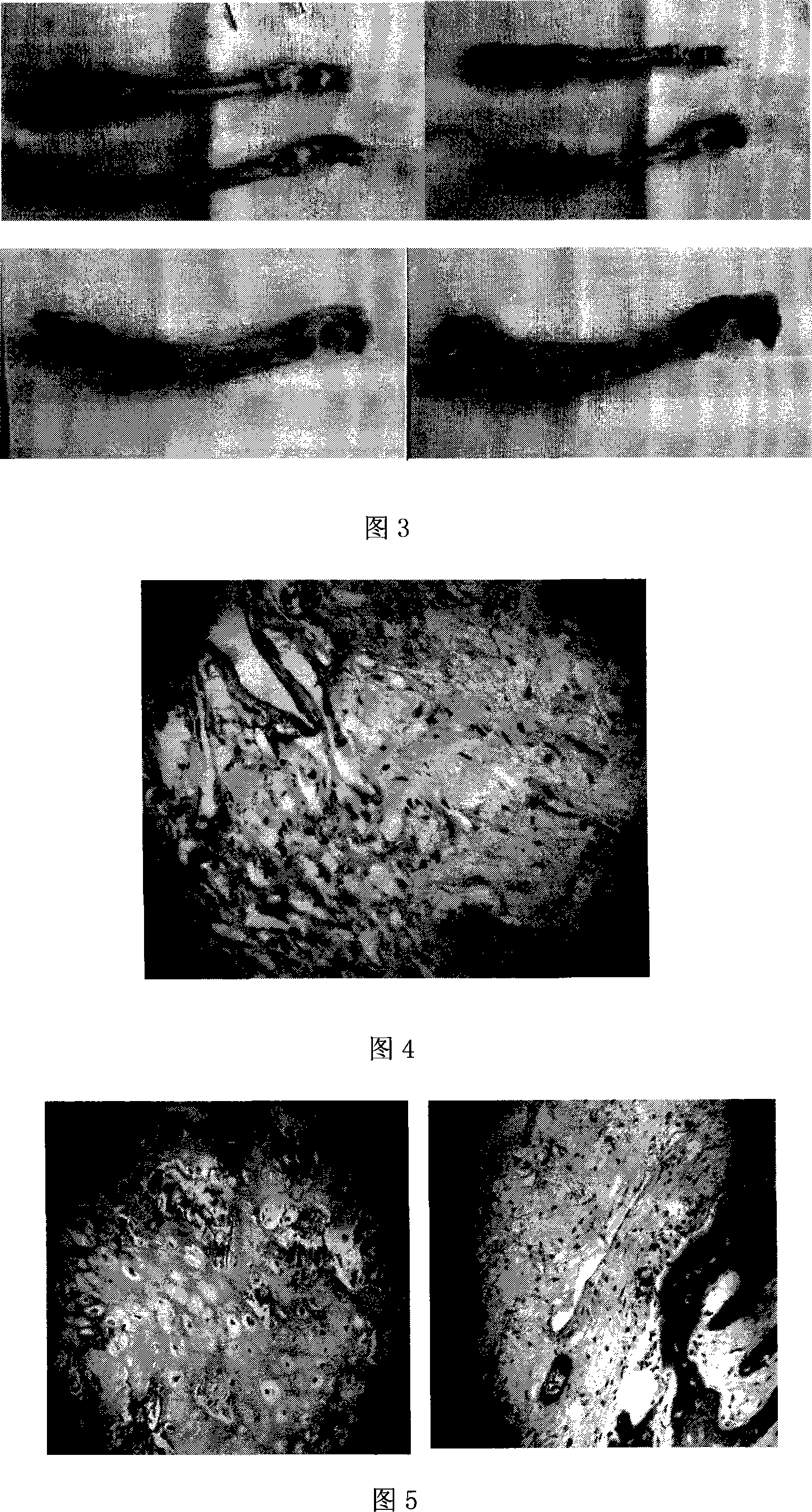 Tissue engineering bone complex and application