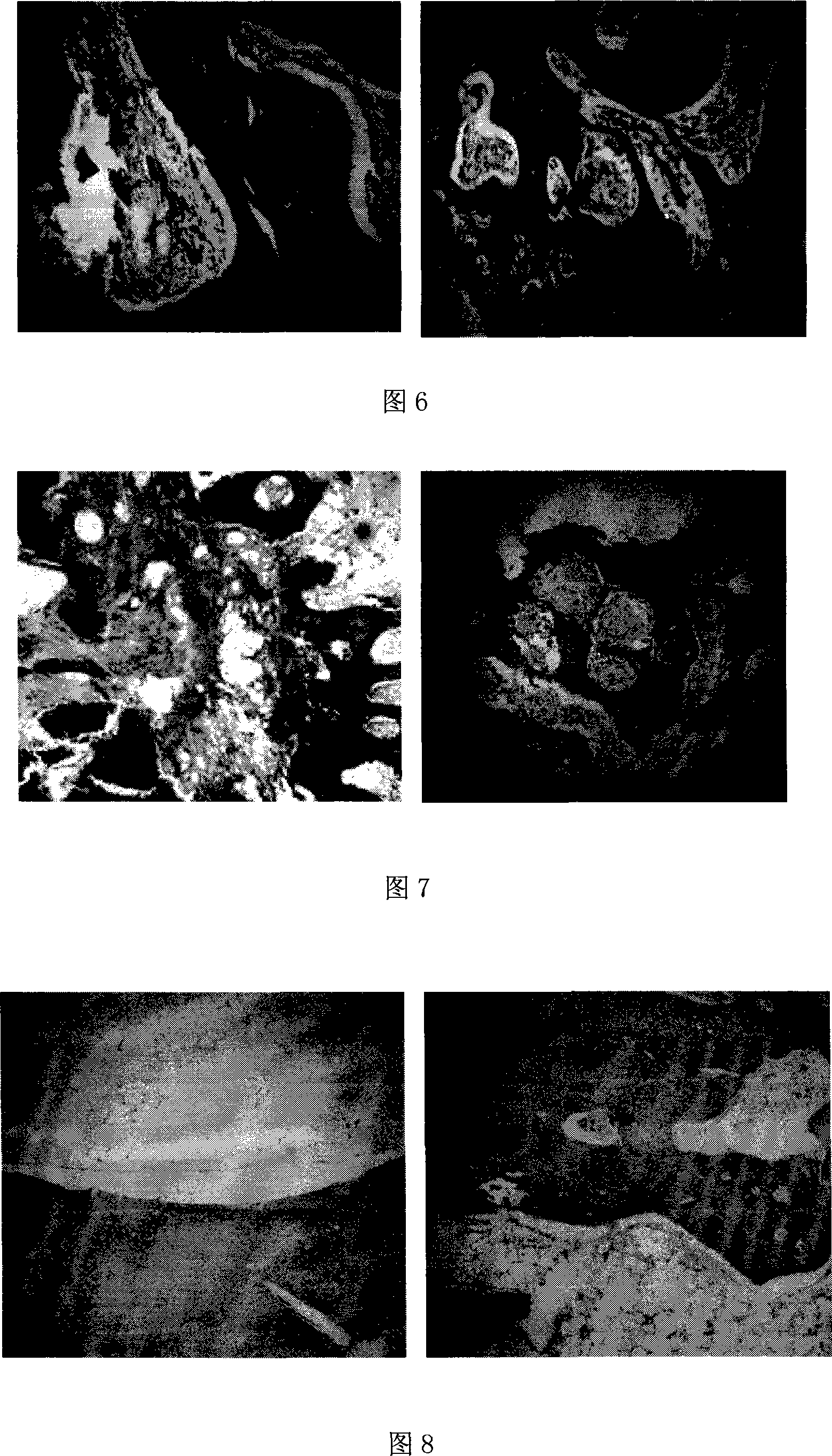 Tissue engineering bone complex and application