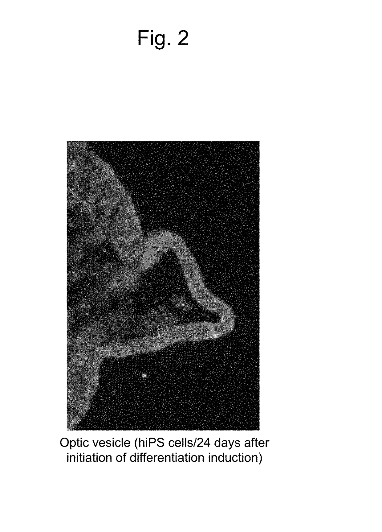 Method for preparation of retinal ganglion cells