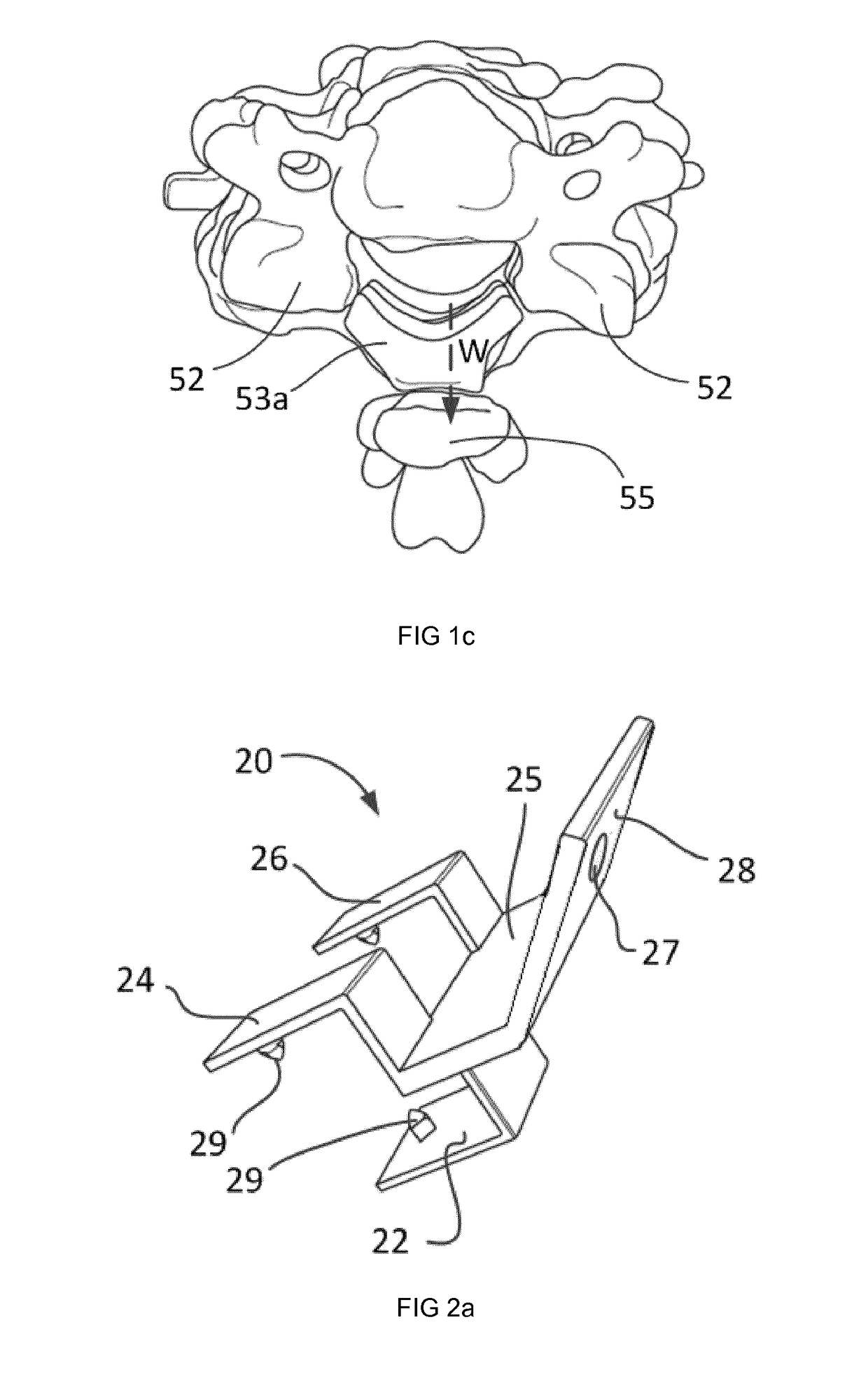 Surgical instruments and methods