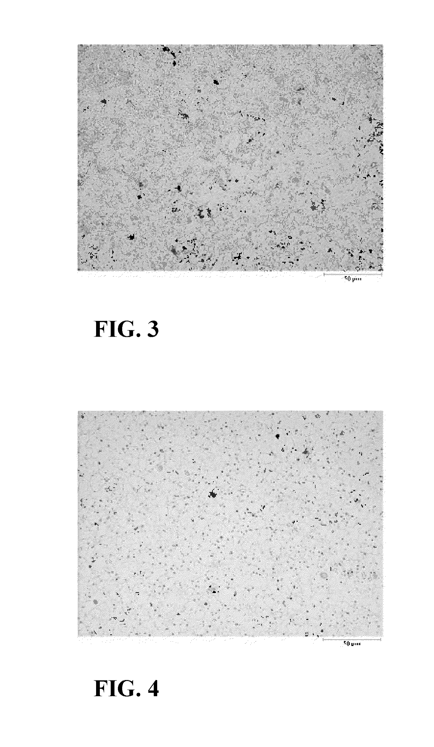 Implant made of a biodegradable magnesium alloy