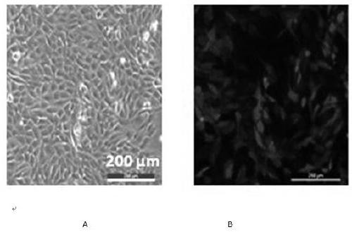 Fluorescence labeled human triple-negative breast cancer osseous metastasis cell line