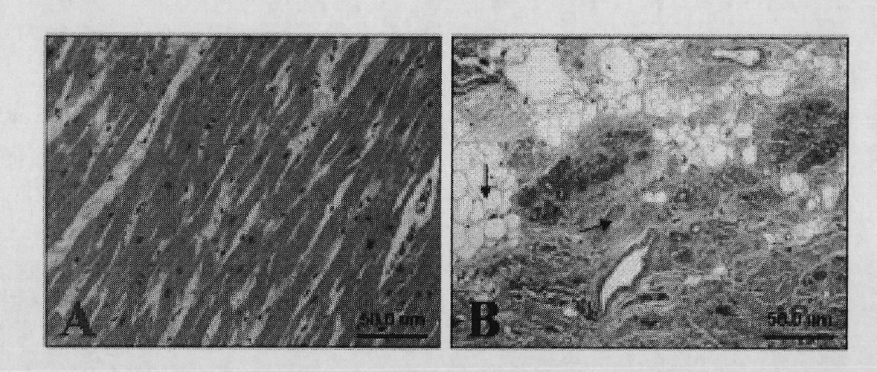 Application of LTBP-2 (Latent transforming growth factor beta binding protein 2) in preparation of cardiac failure test kit and kit containing LTBP-2