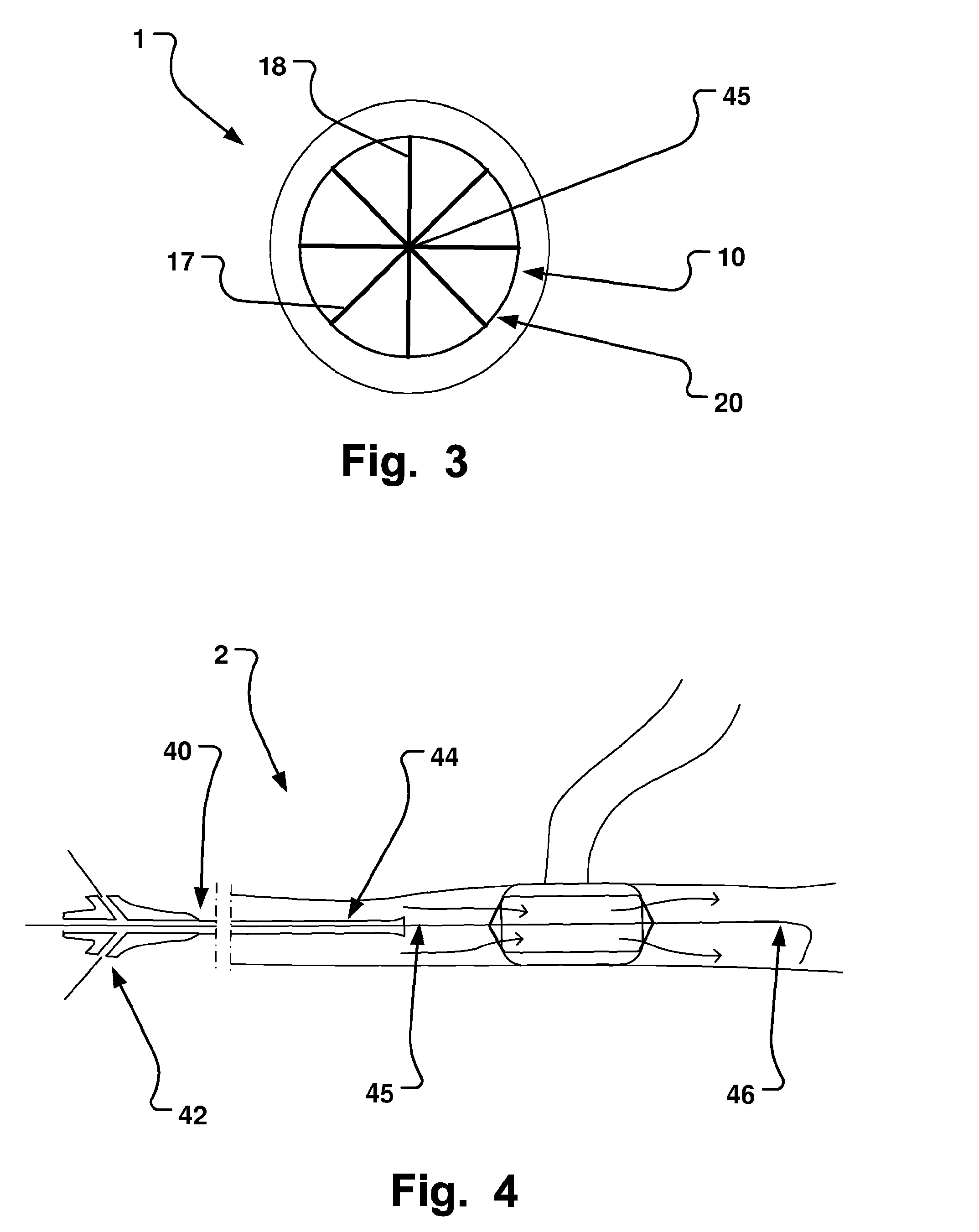 Medical Device, Method And System For Temporary Occlusion Of An Opening In A Lumen Of A Body