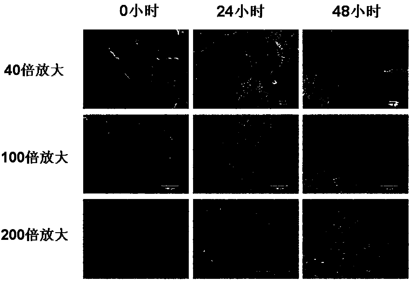 Culture medium, kit and application thereof