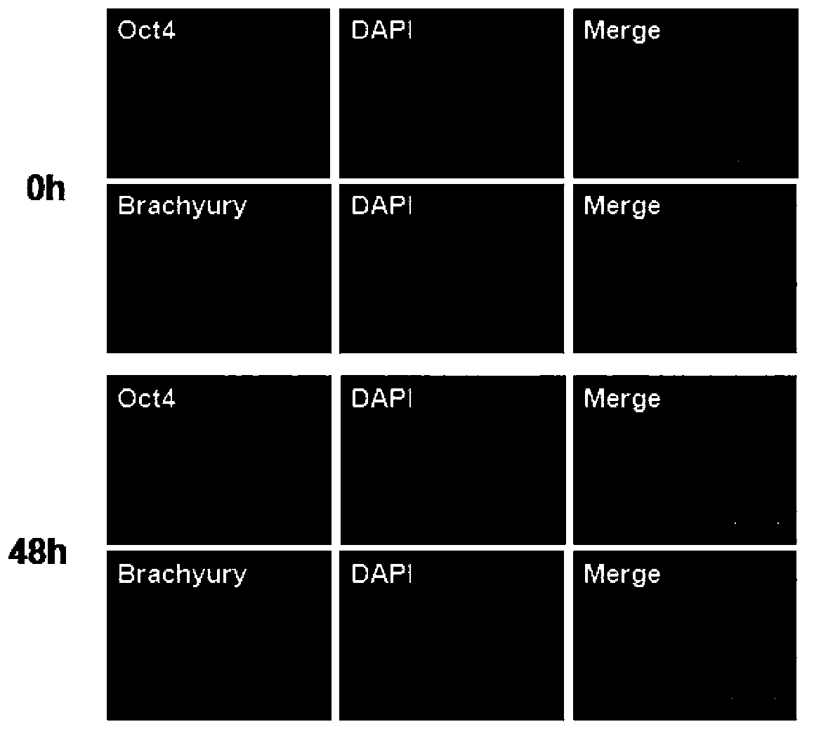 Culture medium, kit and application thereof