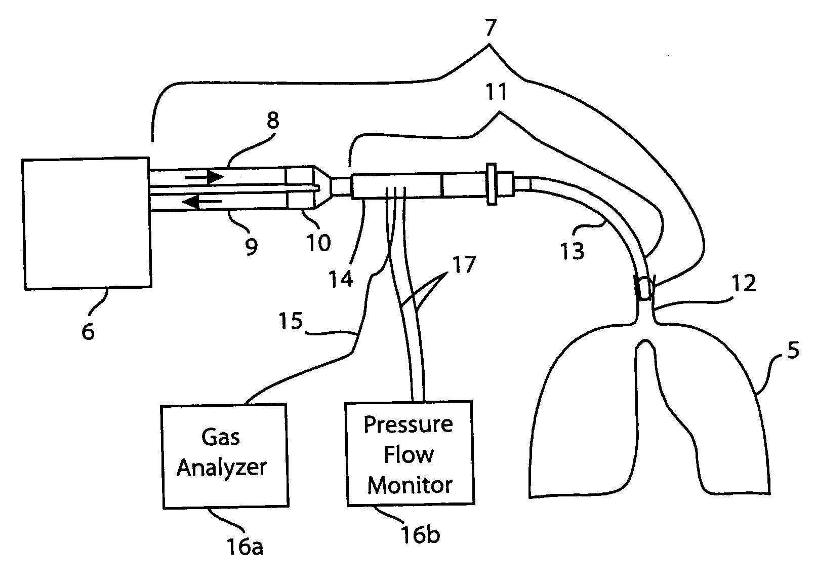 Method for indicating the amount of ventilation inhomgeneity in the lung