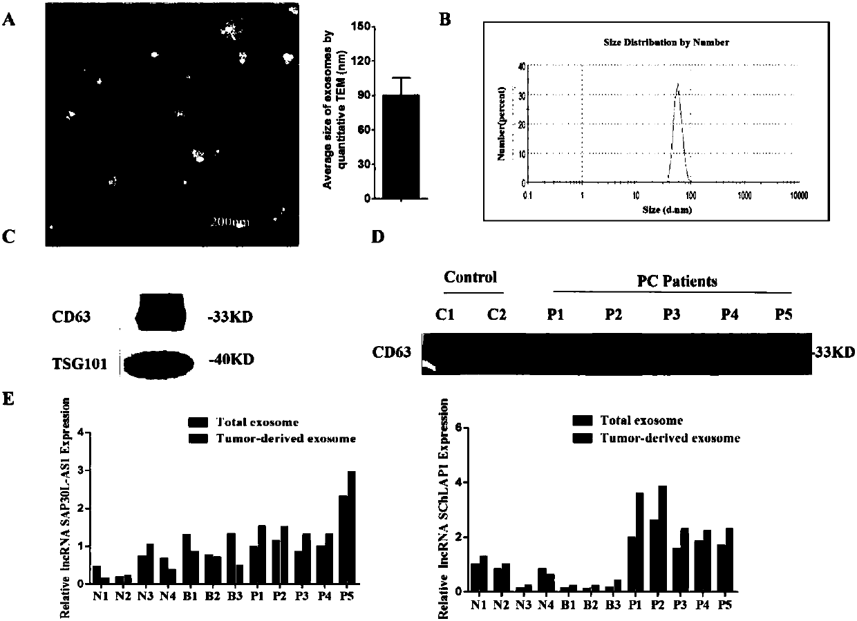 Prostate cancer-specific exosome, IncRNA and preparation methods and application thereof