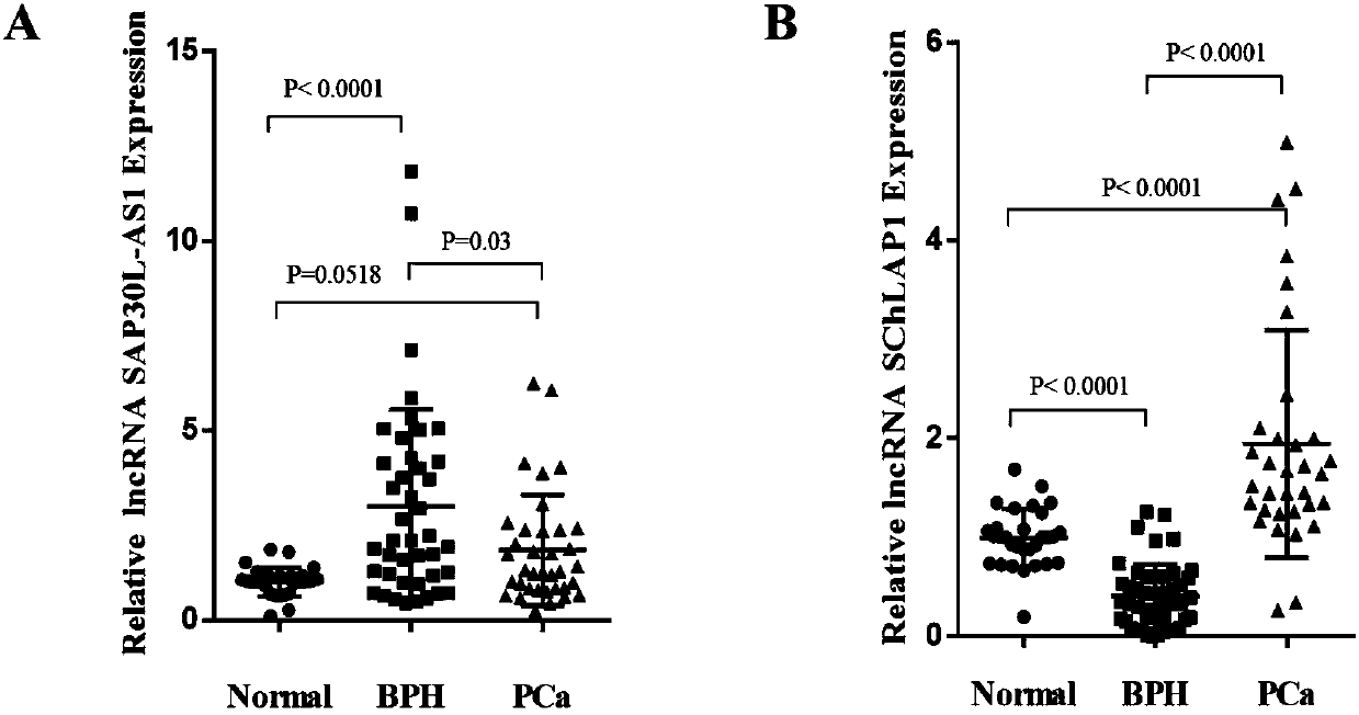 Prostate cancer-specific exosome, IncRNA and preparation methods and application thereof