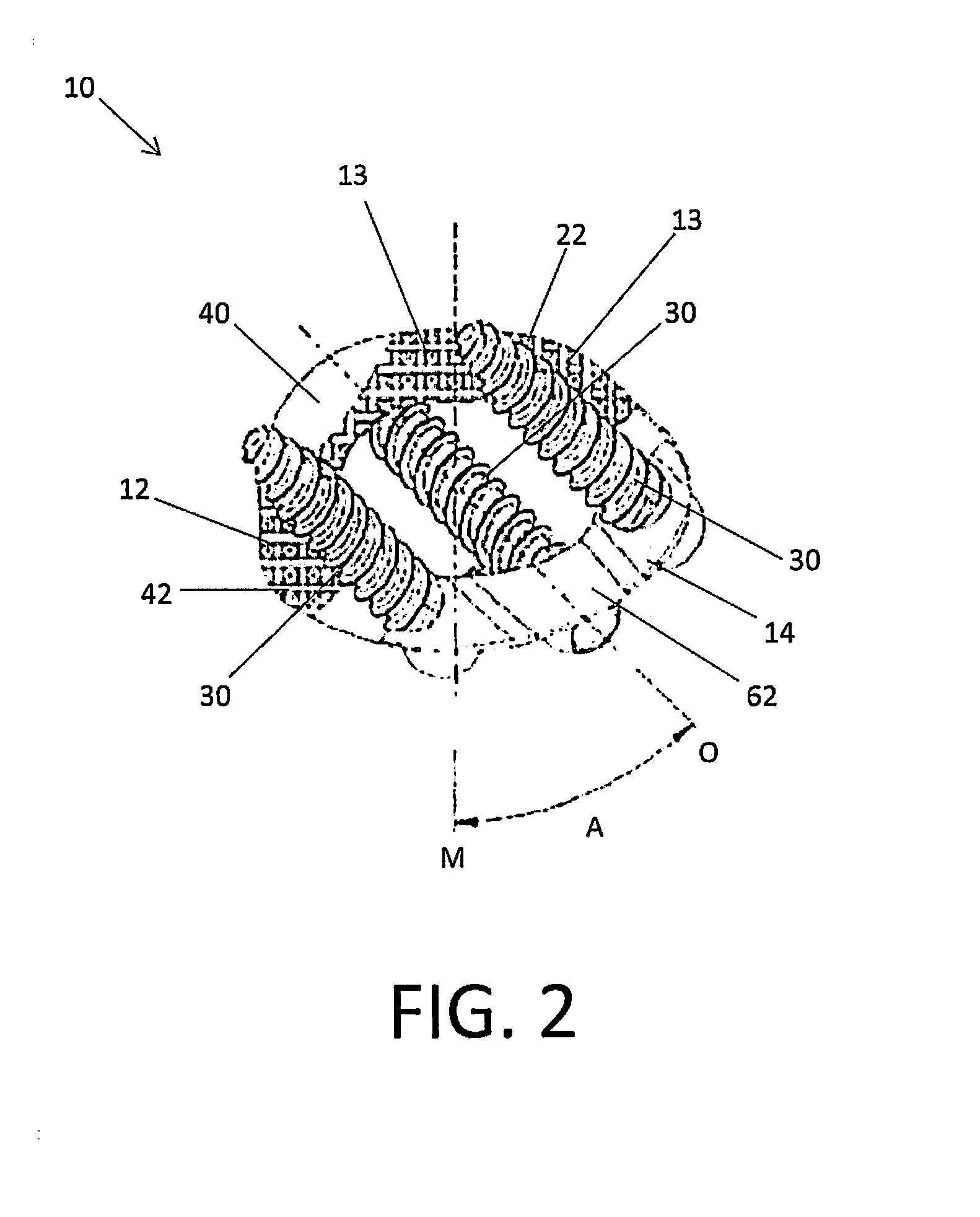 Interbody Standalone Intervertebral Implant