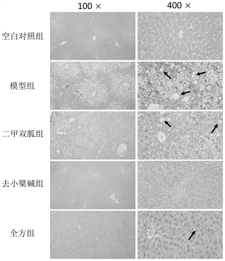 Pueraria, scutellaria baicalensis and coptis extract, preparation method, pharmaceutical preparation and application