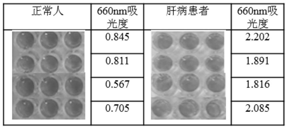 MTC dye-based visual detection method of blood unbound transferrin and application thereof