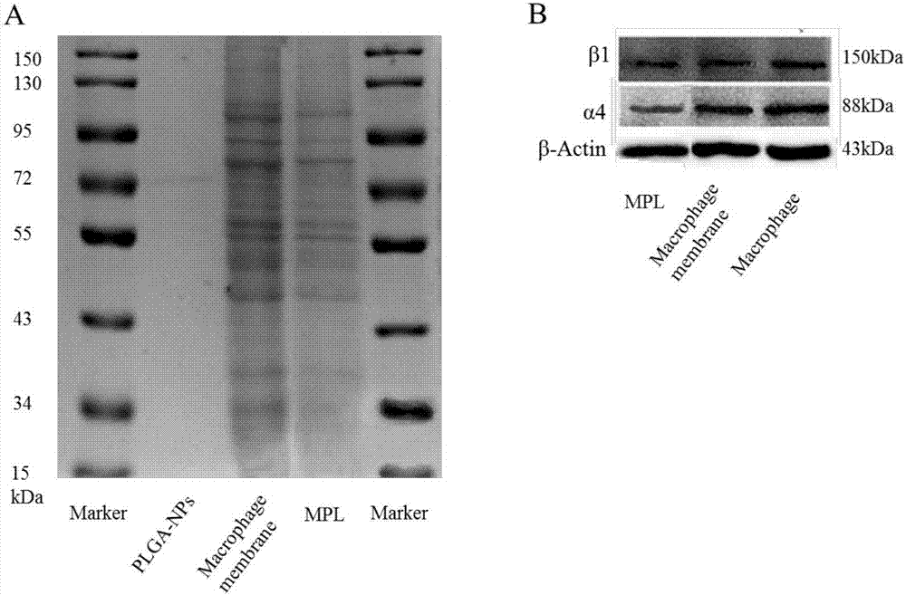 Targeting atherosclerotic focus cell membrane bionic drug-delivery system preparation method and product and application thereof