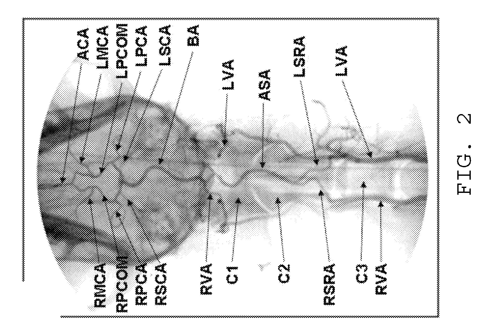 Method for testing an agent for strokes in humans with a non-human stroke model