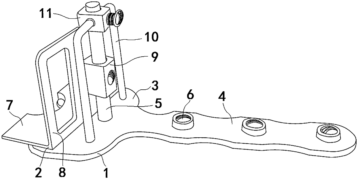 Auxiliary knee arthroplasty clearance balance tool