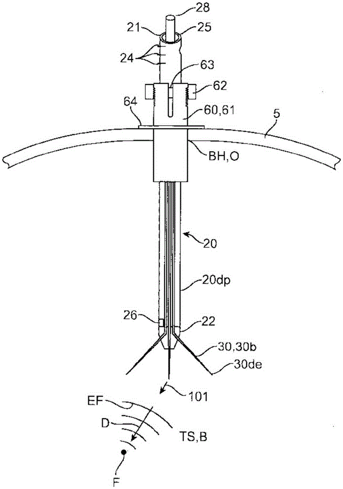 Apparatus, systems and methods for delivery of medication to the brain to treat neurological condidtions