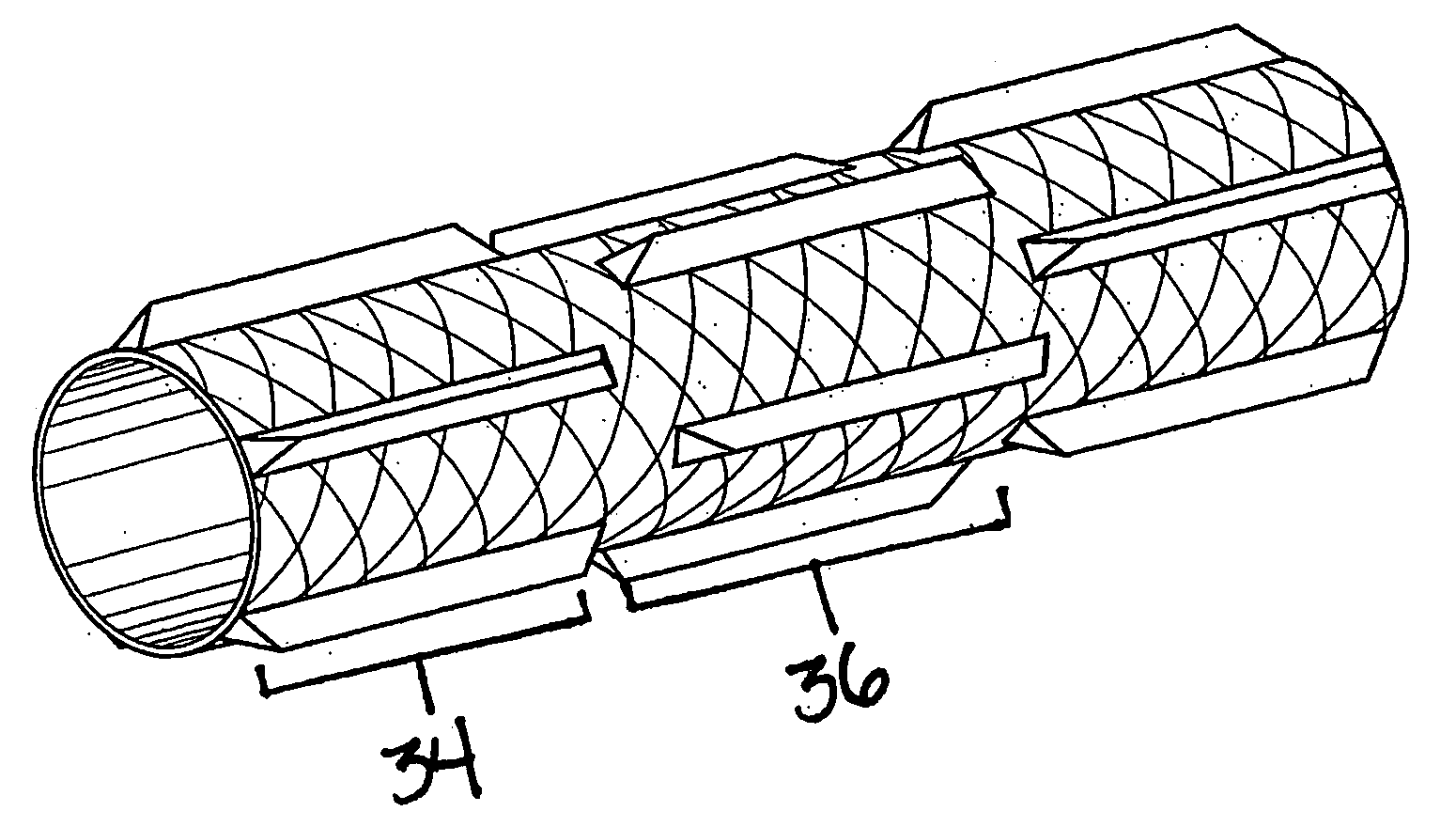 Cutting stent