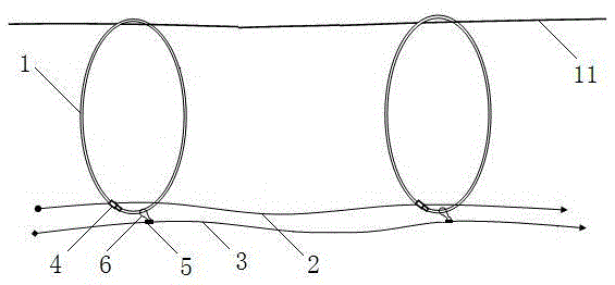 Tension-free cable layover device