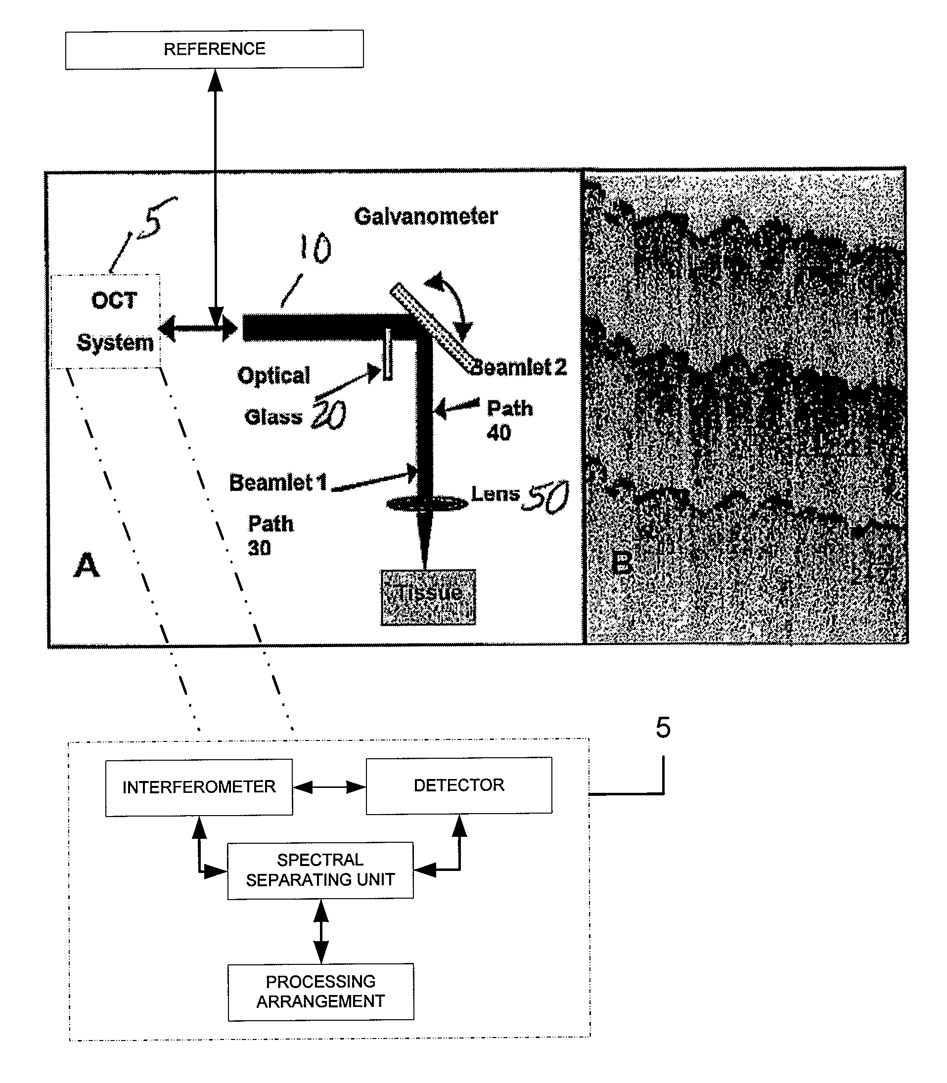 Speckle reduction in optical coherence tomography by path length encoded angular compounding