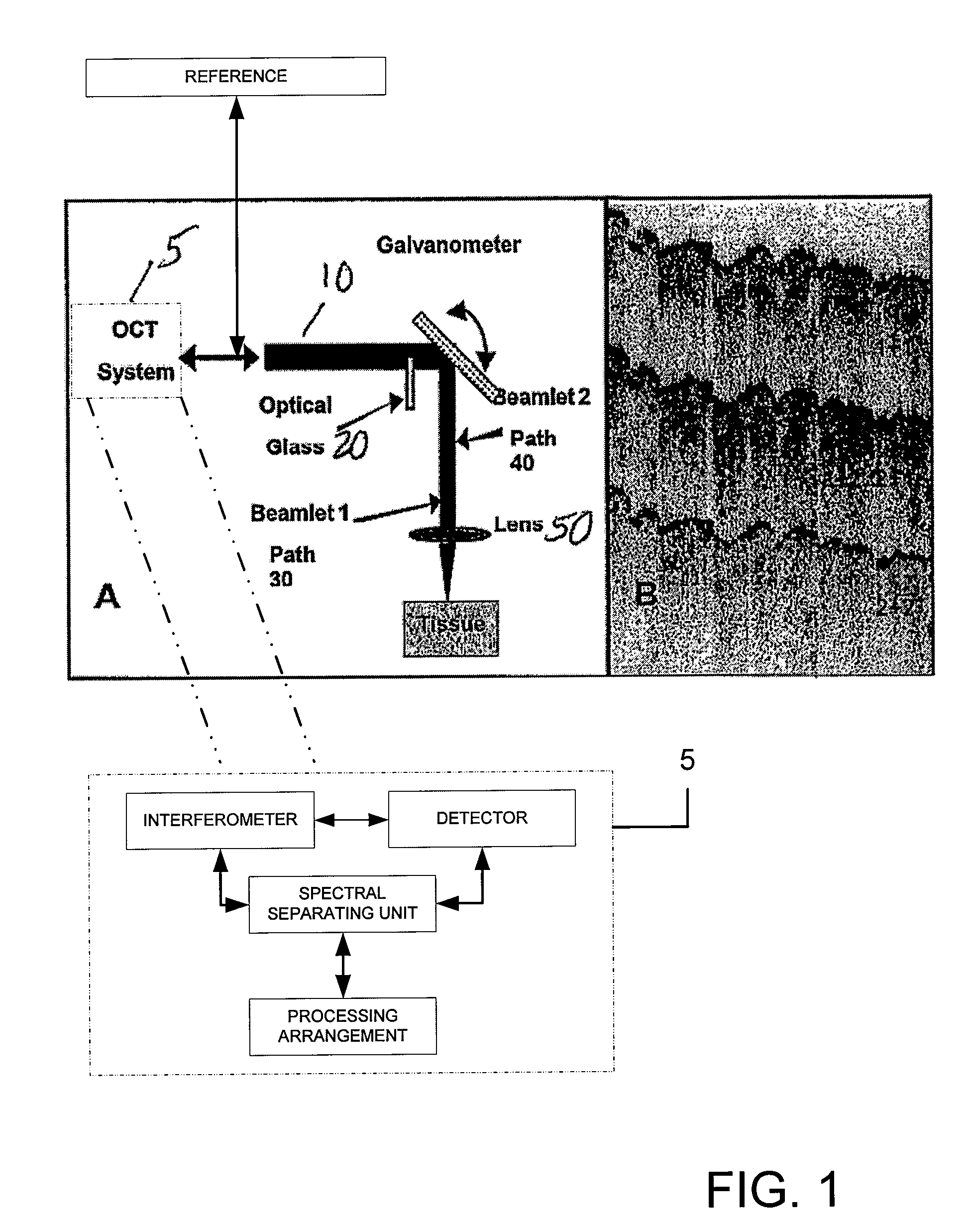 Speckle reduction in optical coherence tomography by path length encoded angular compounding