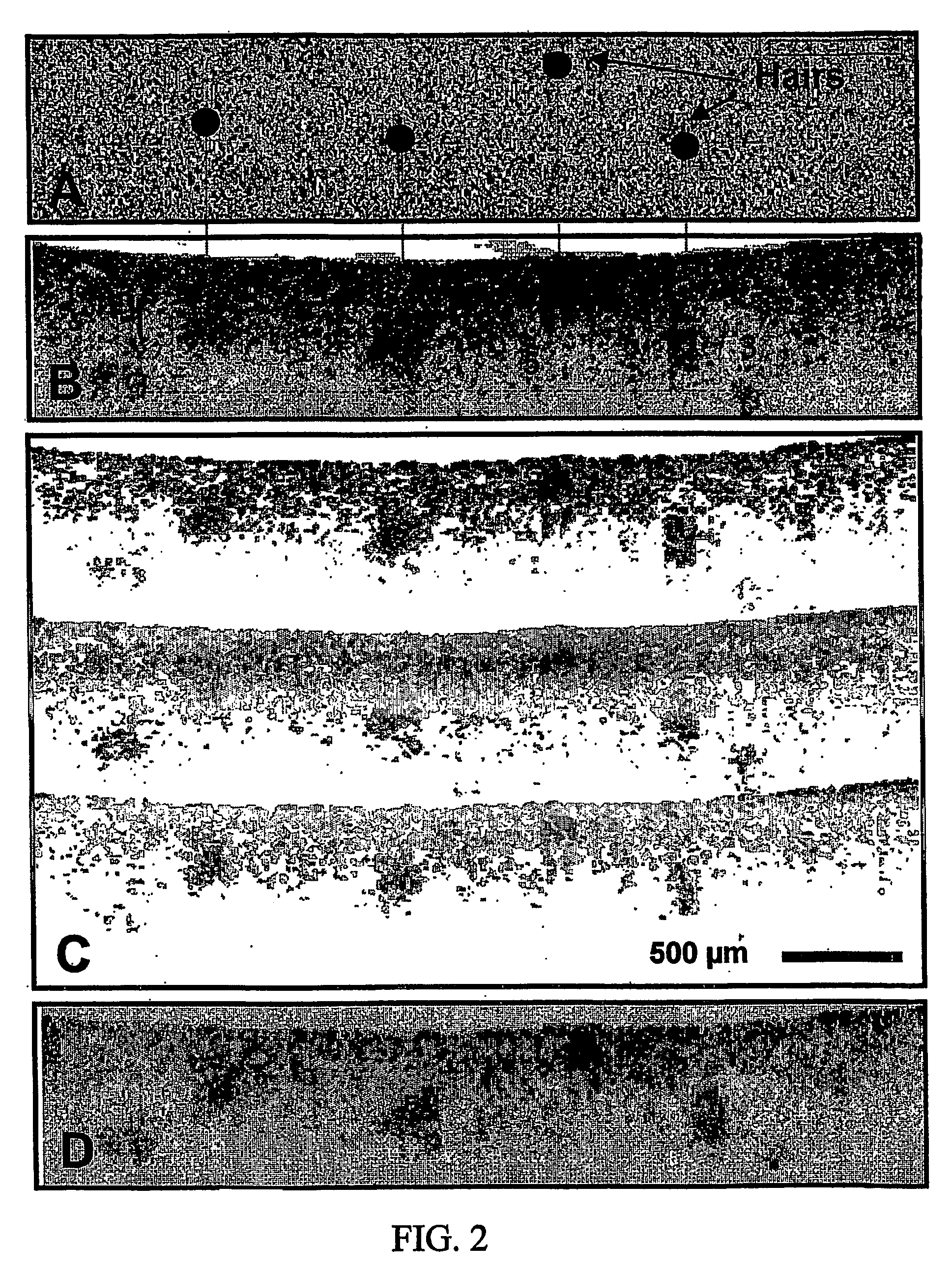 Speckle reduction in optical coherence tomography by path length encoded angular compounding