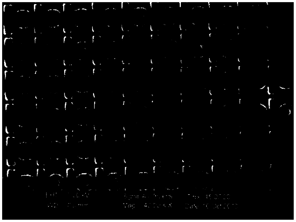 Medium nanometer light wave antenna sensor based on rod-ring structure and application