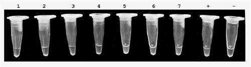 Loop-mediated isothermal amplification detection primer set, method and kit for detection of Xanthomonas oryzae