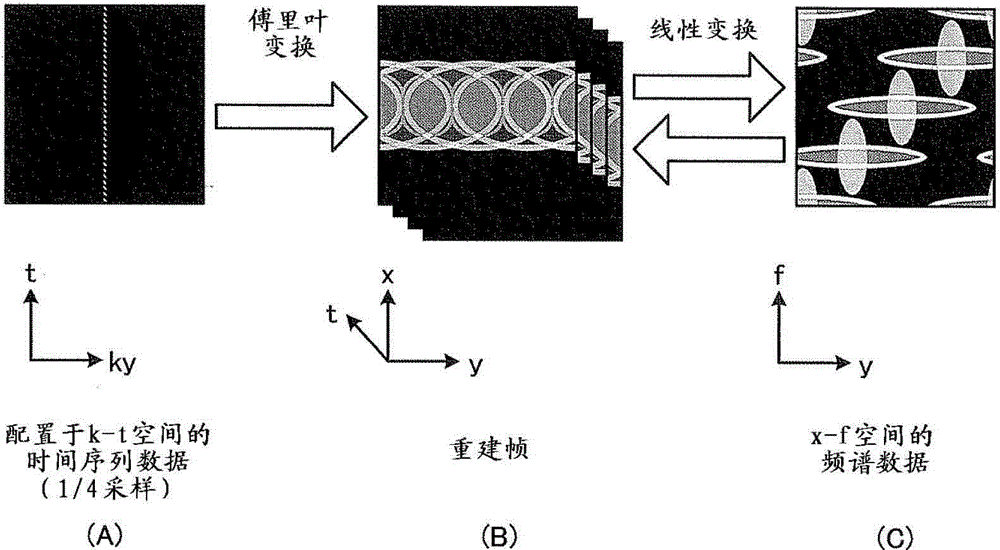 Magnetic resonance imaging apparatus and image processing apparatus