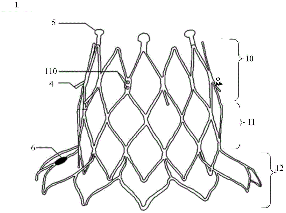 Involved artificial heart valve prosthesis