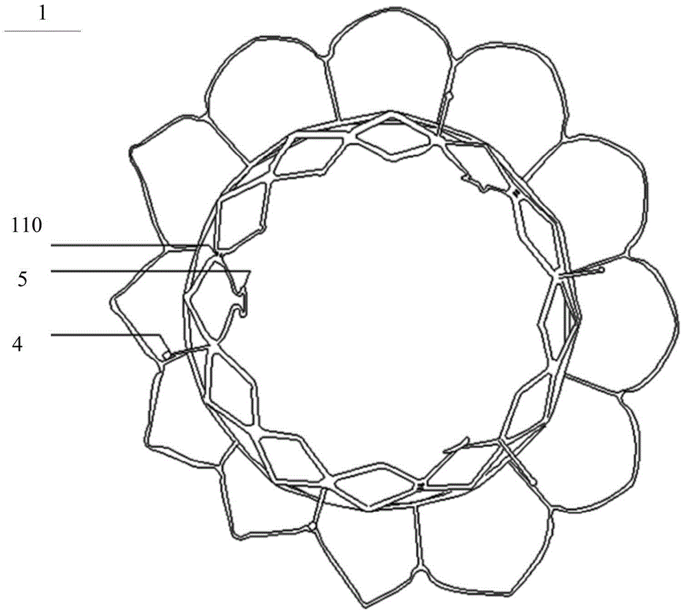 Involved artificial heart valve prosthesis