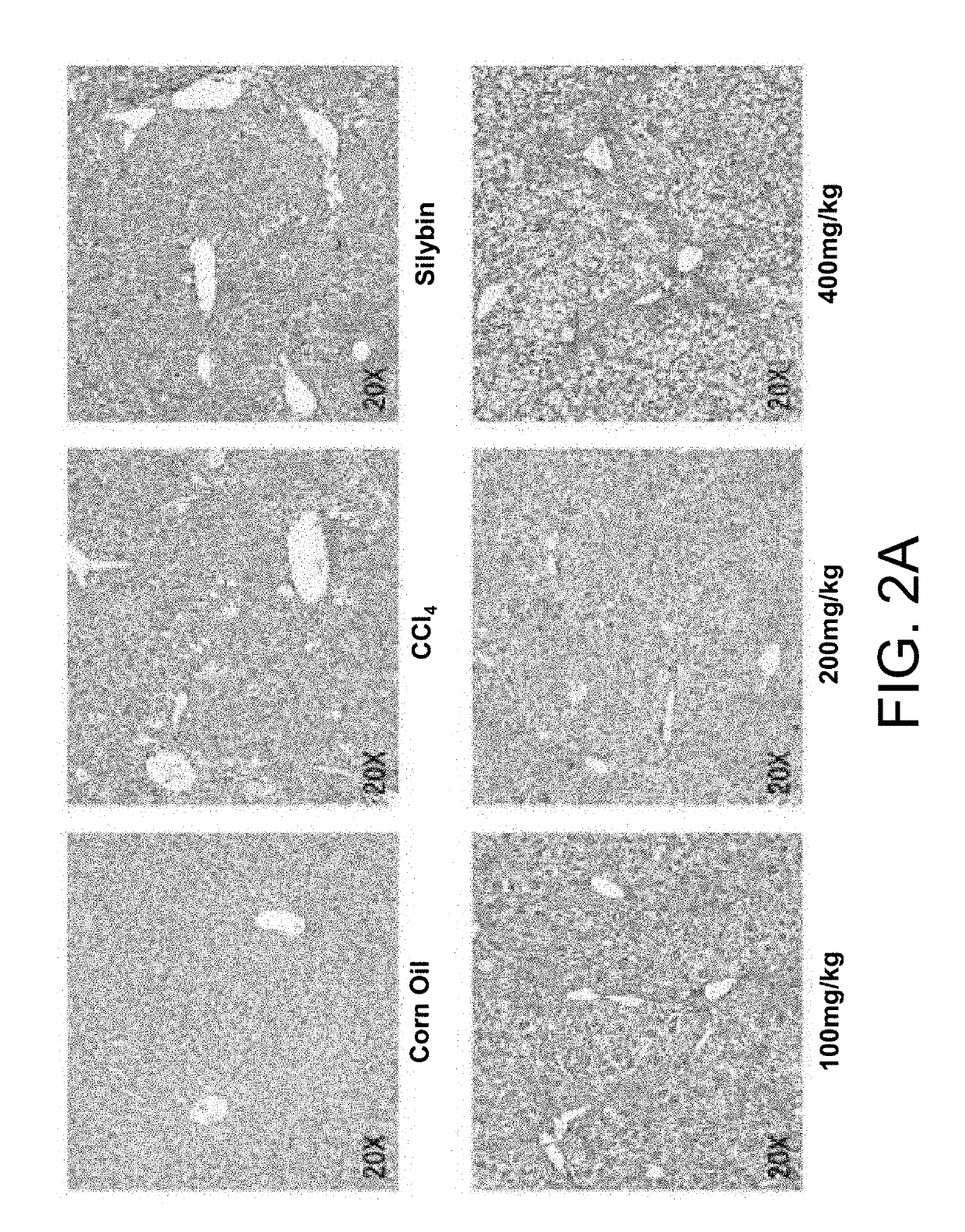 Application of longhu rendan in preparing medicament for preventing and/or treating liver fibrosis