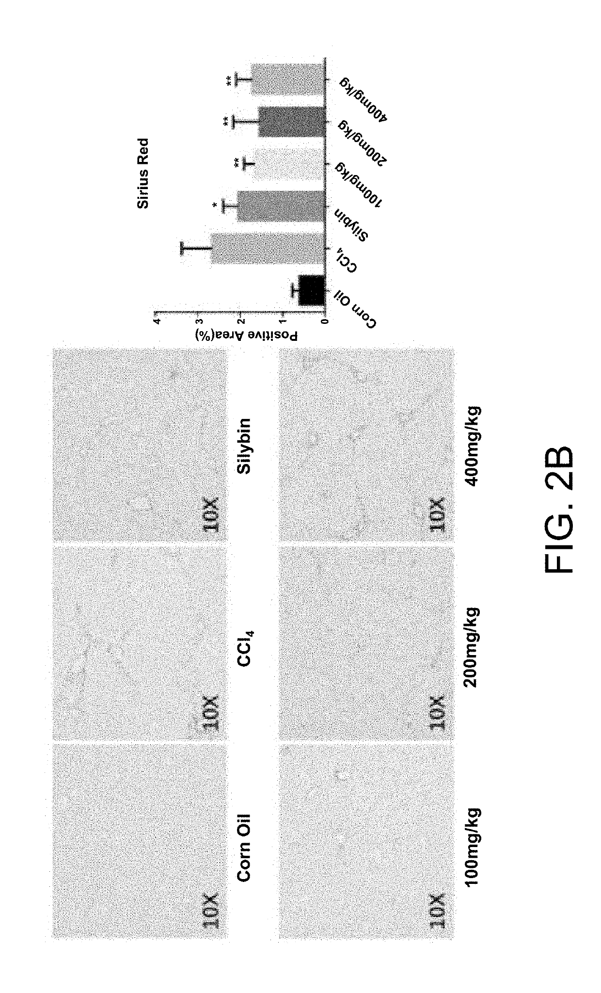 Application of longhu rendan in preparing medicament for preventing and/or treating liver fibrosis