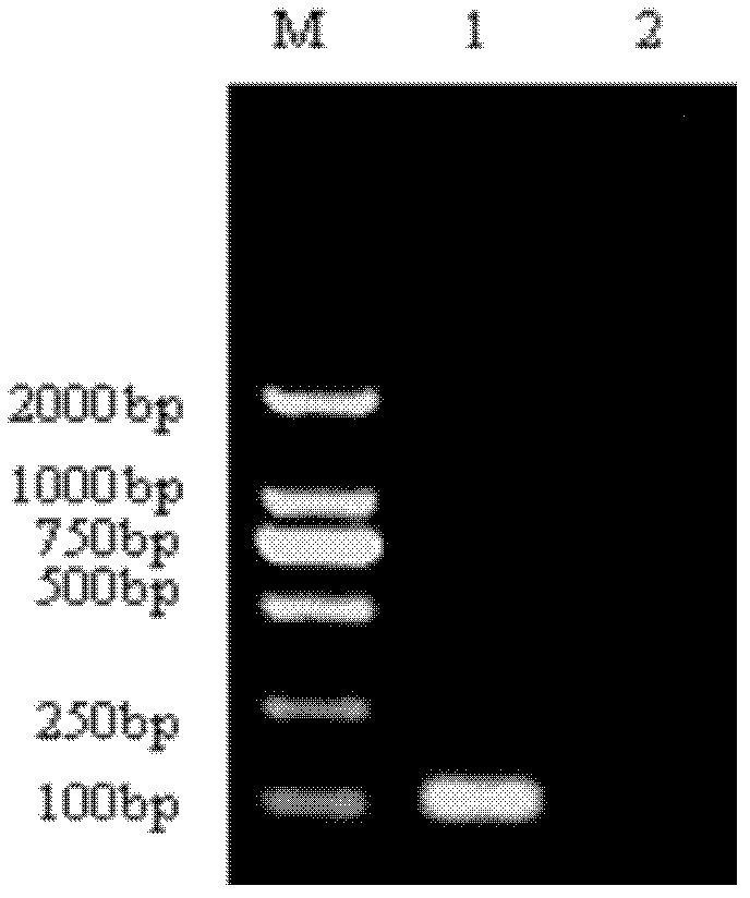 Kit for detecting Listeria monocytogenes and staphylococcus aureus, and application thereof