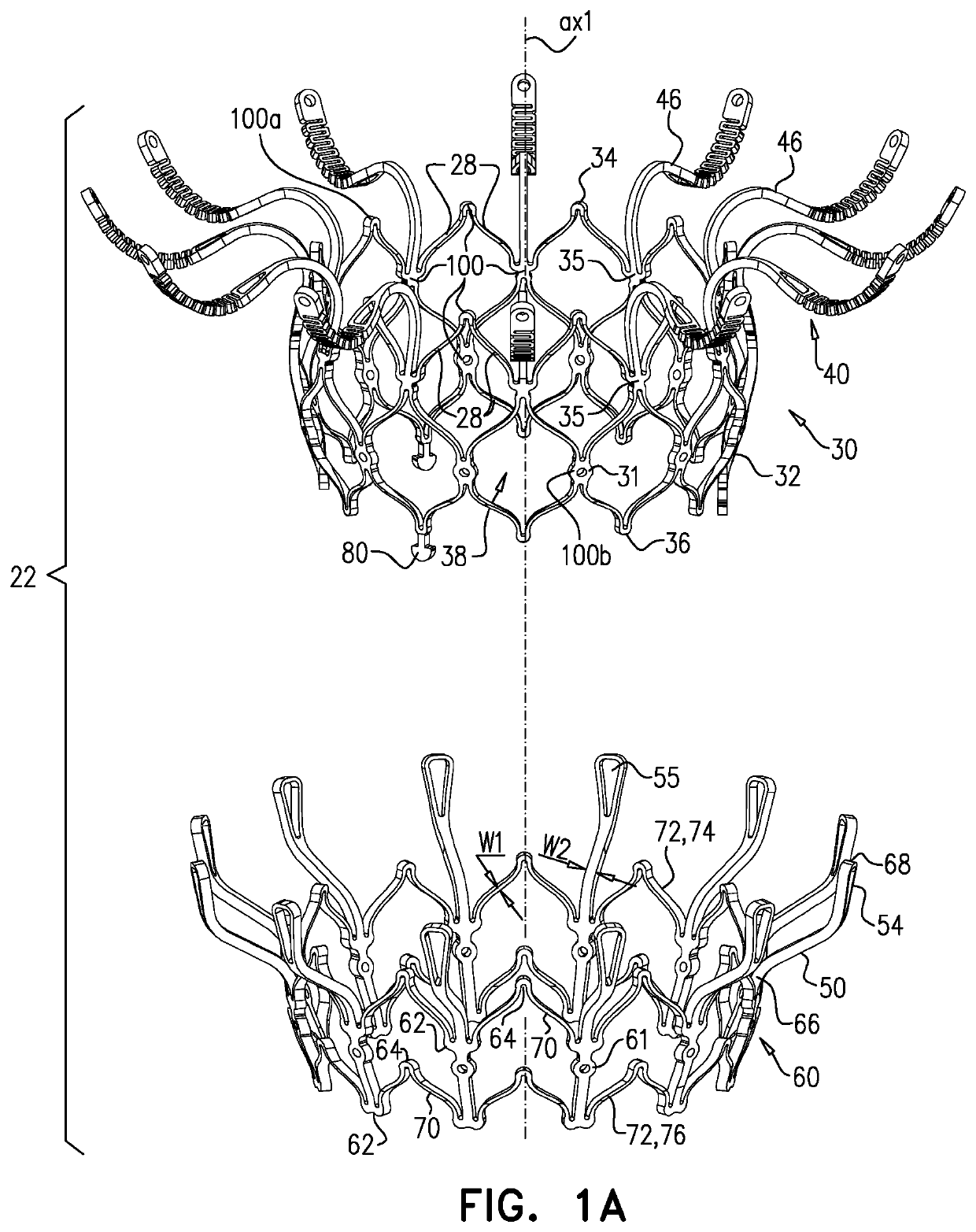 Prosthetic heart valve