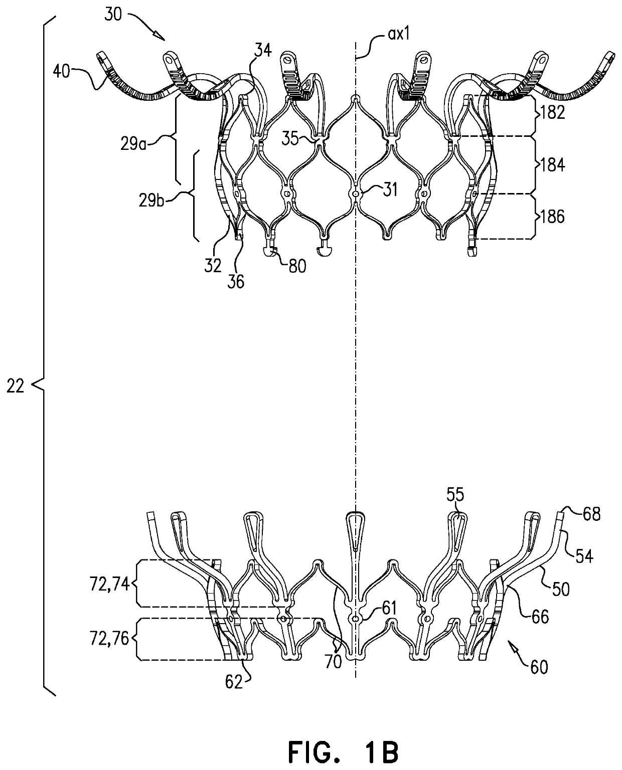 Prosthetic heart valve