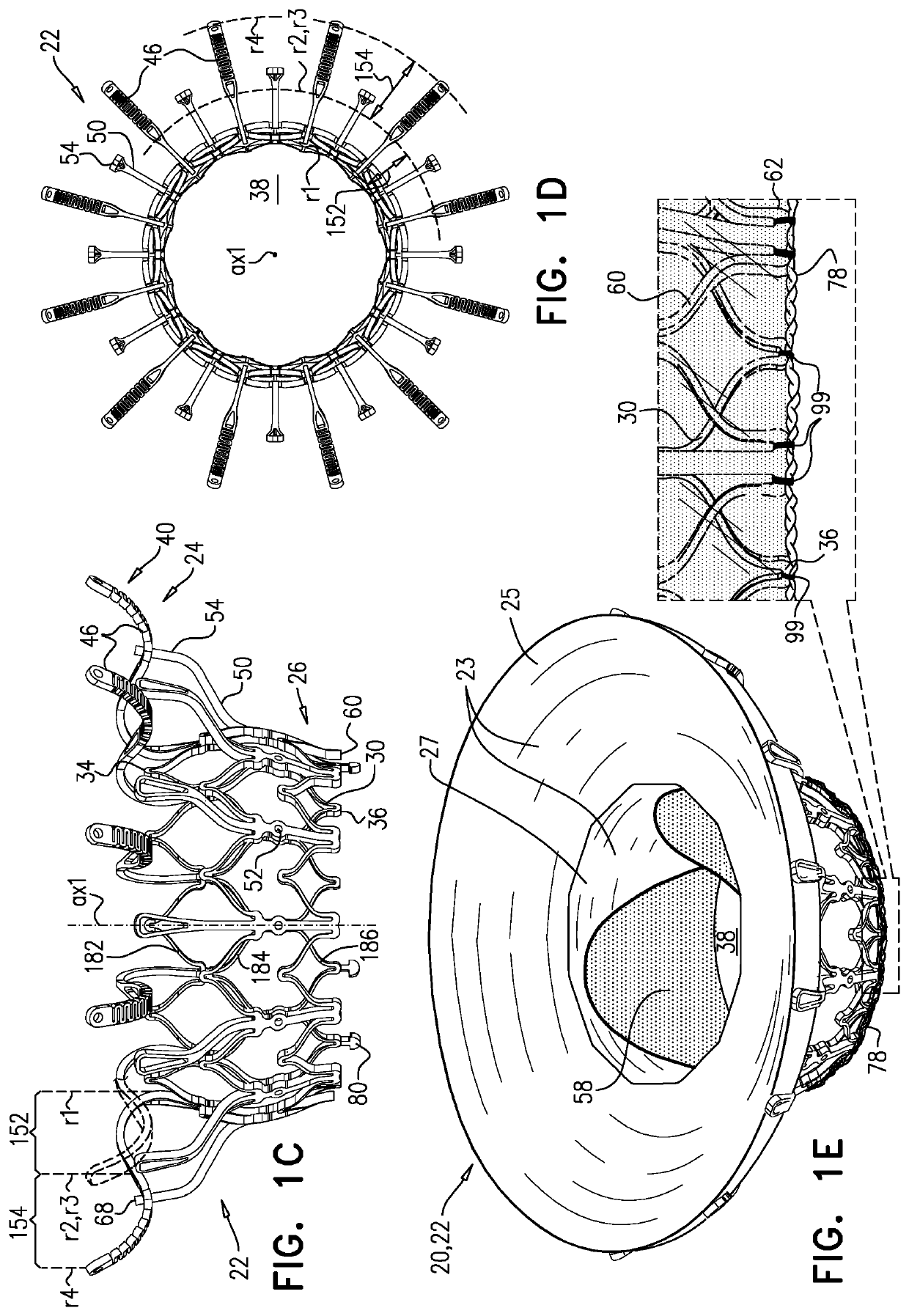 Prosthetic heart valve