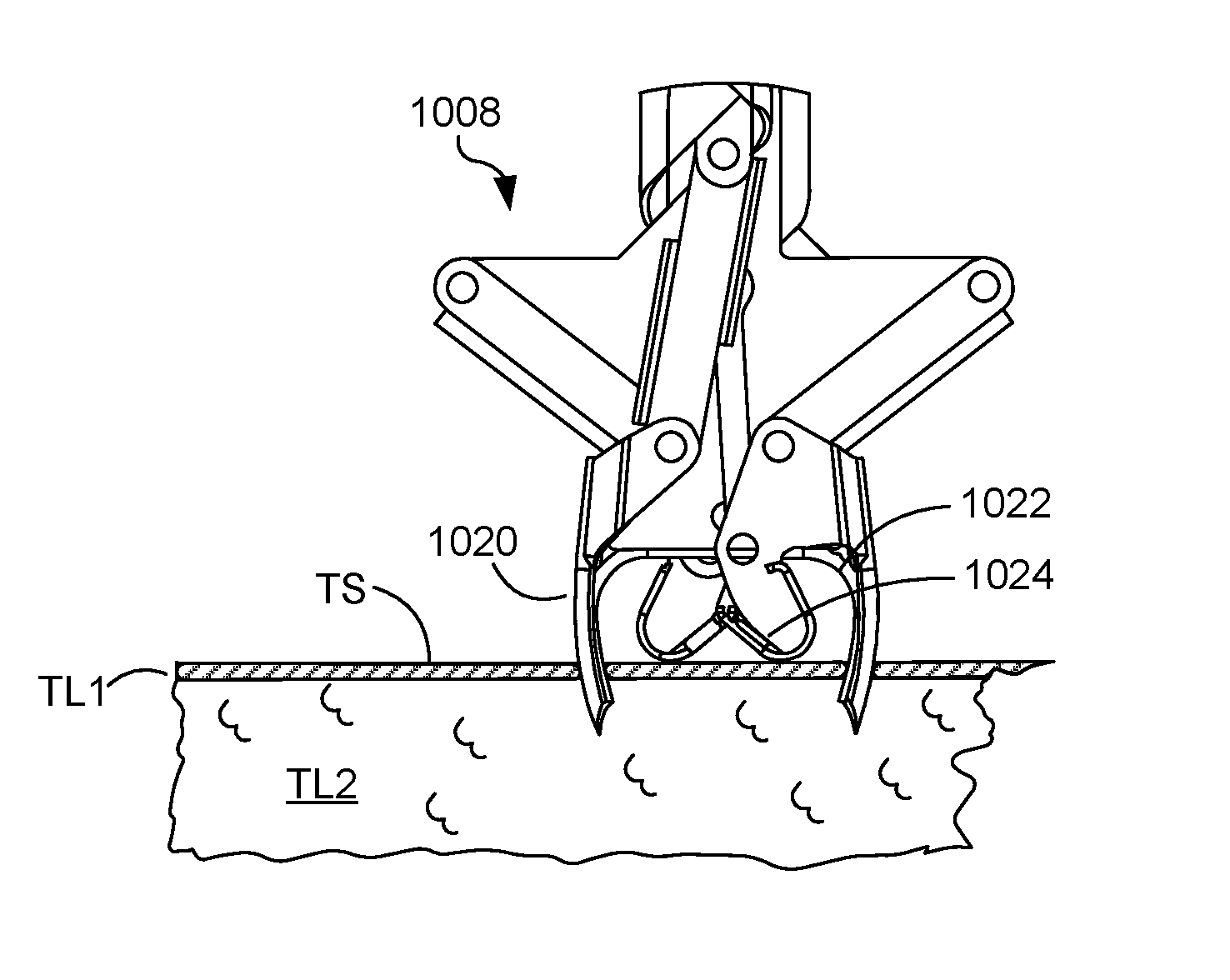 Fasteners, deployment systems, and methods for ophthalmic tissue closure and fixation of ophthalmic prostheses and other uses