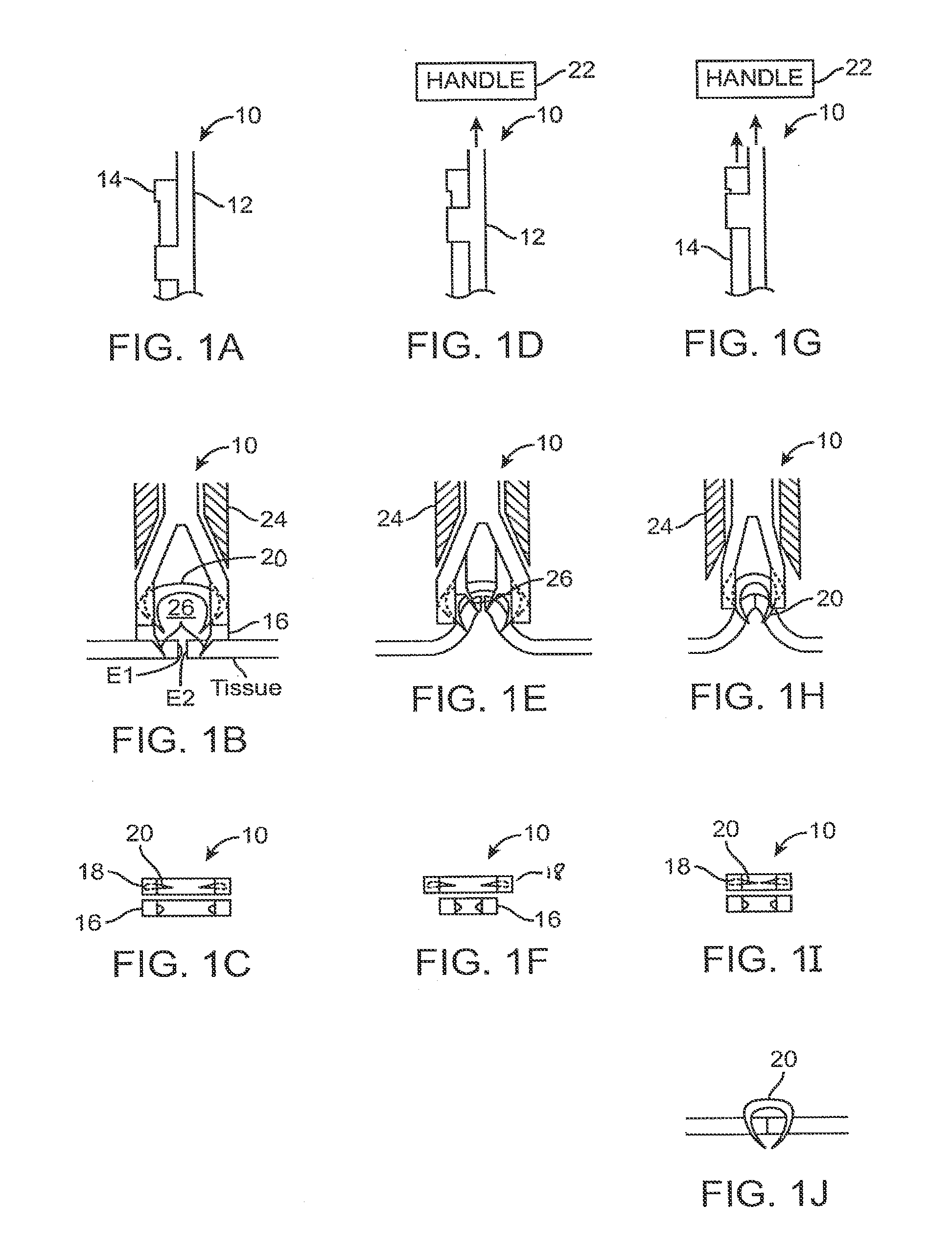 Fasteners, deployment systems, and methods for ophthalmic tissue closure and fixation of ophthalmic prostheses and other uses