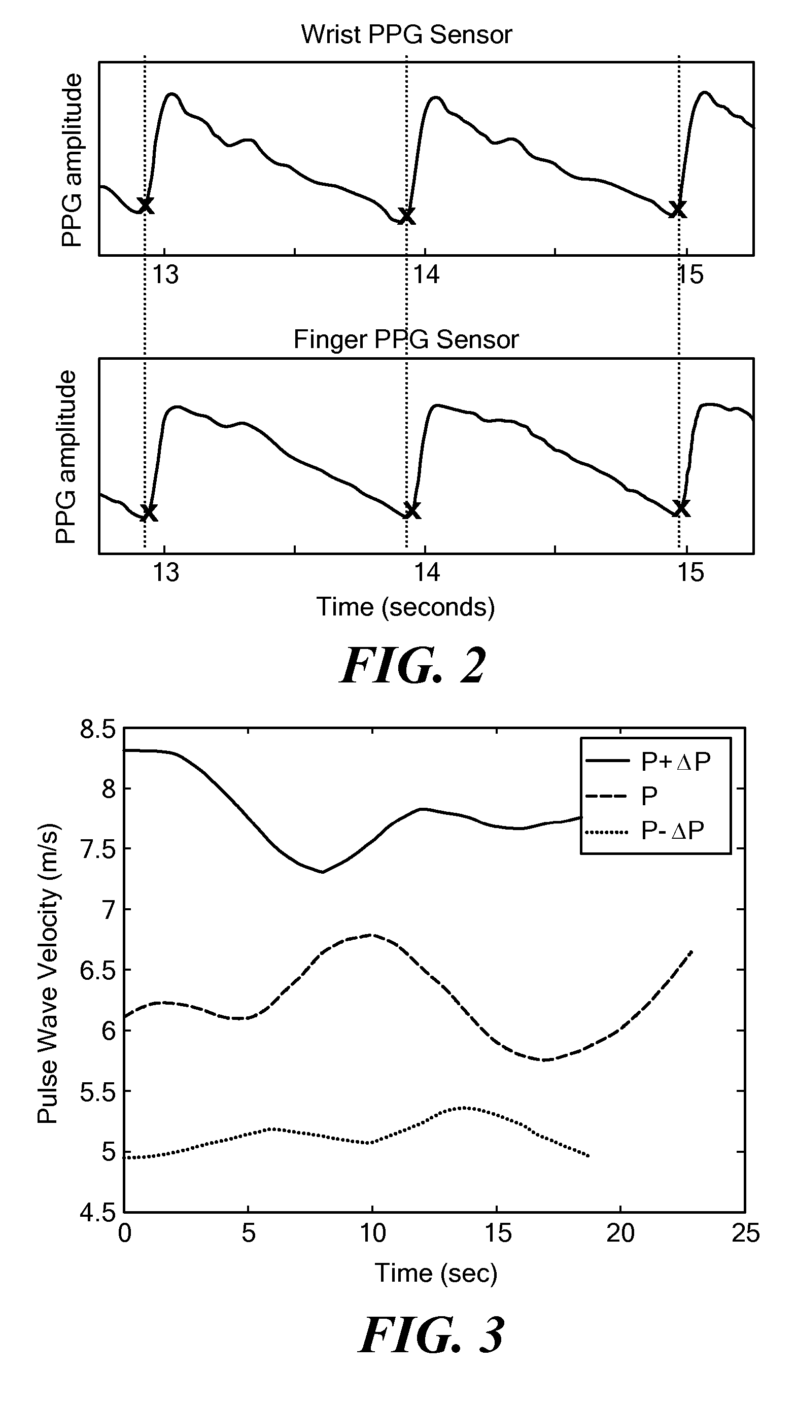 Wearable Pulse Wave Velocity Blood Pressure Sensor and Methods of Calibration Thereof