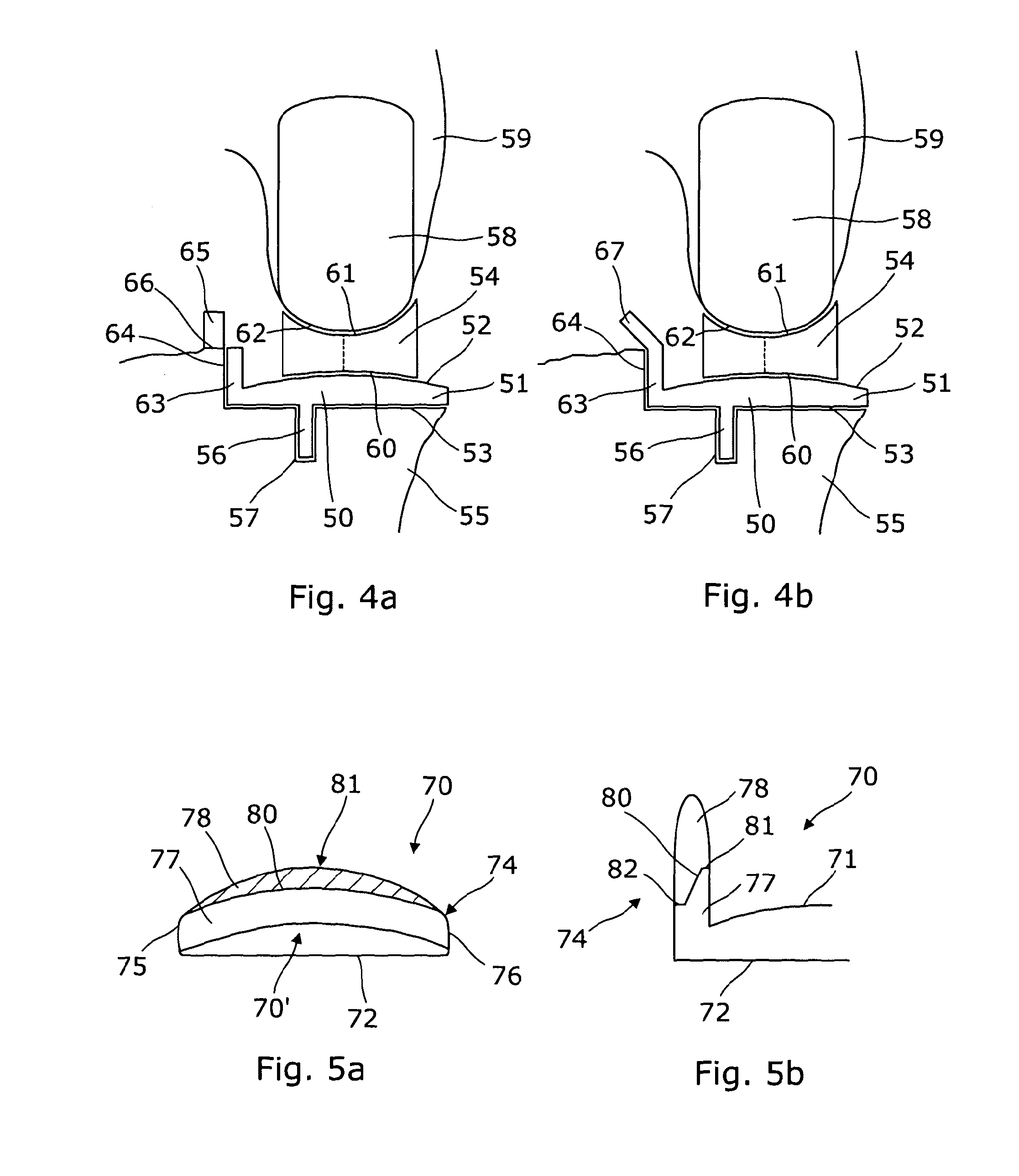 Femoral extension prosthetic component and tibial shelf prosthetic component for unicondylar meniscal bearing knee prosthesis and prosthesis including such a component