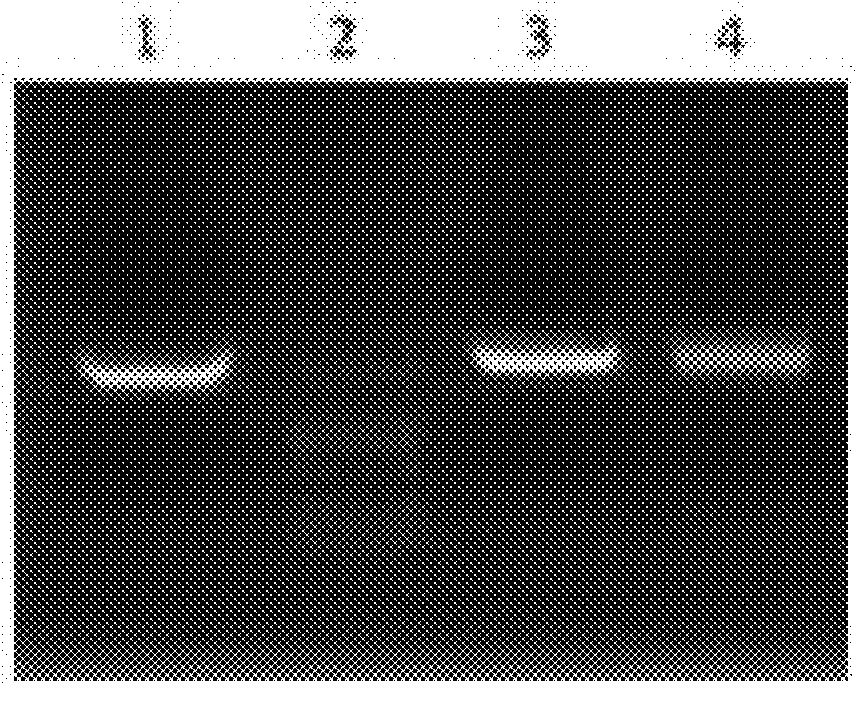 Ebola Virus Disease Vaccine Taking Human Replication Deficient Adenovirus As Vector