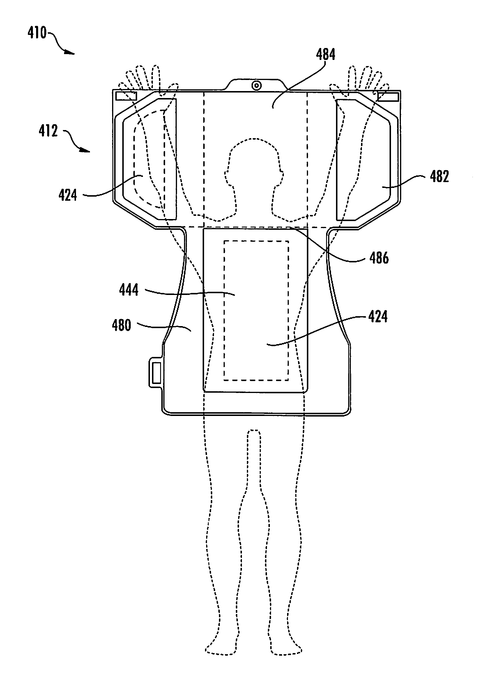 Radiotherapy patient immobilization device and method